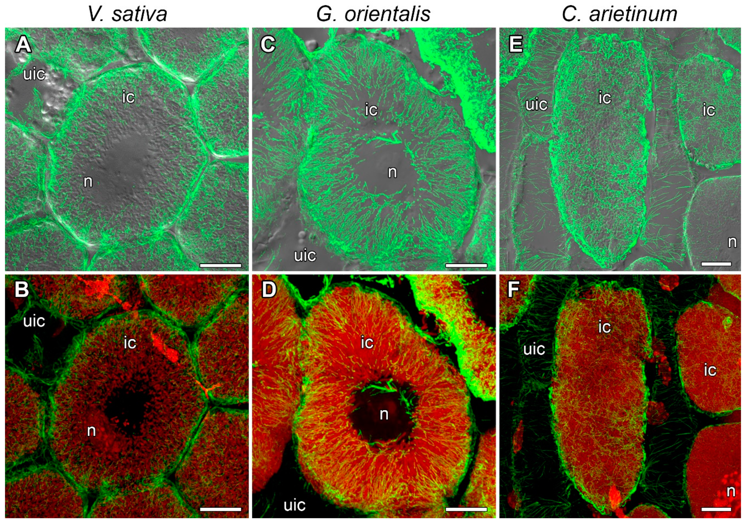 Cells Free Full Text General Patterns And Species Specific Differences In The Organization Of The Tubulin Cytoskeleton In Indeterminate Nodules Of Three Legumes Html