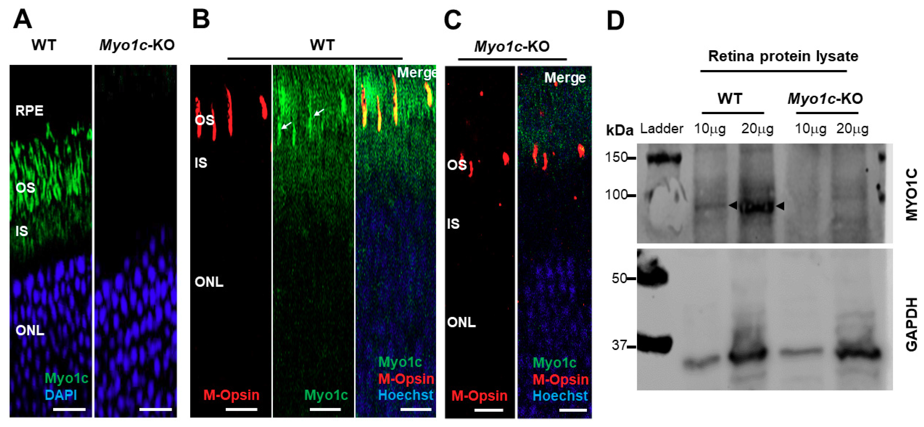 Cells | Free Full-Text | Loss of Motor Protein MYO1C Causes