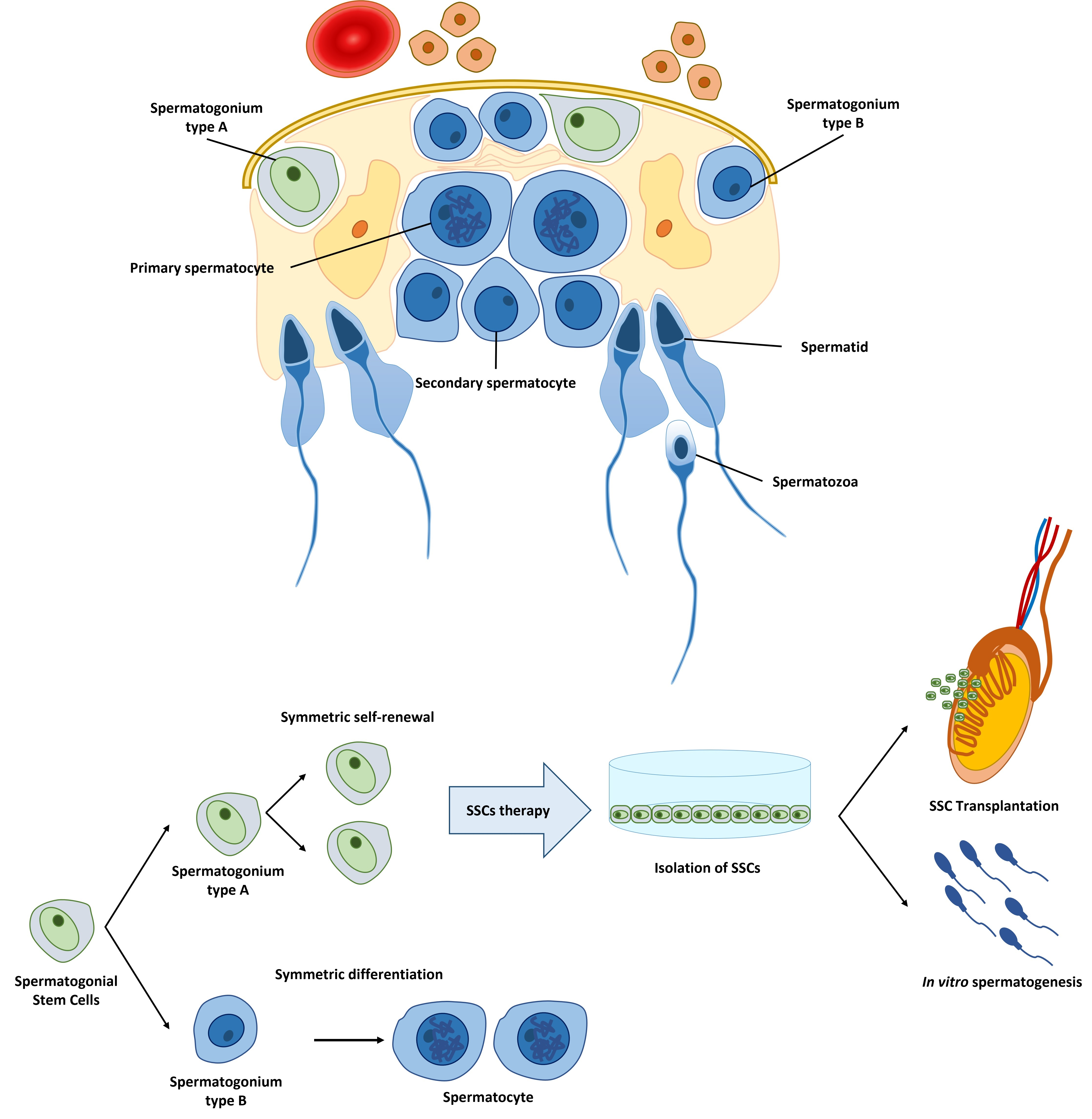 Cells | Free Full-Text | Cellular Therapy via Spermatogonial Stem Cells for  Treating Impaired Spermatogenesis, Non-Obstructive Azoospermia | HTML