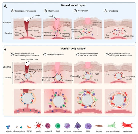 Cells | Free Full-Text | Implant Fibrosis and the Underappreciated Role ...