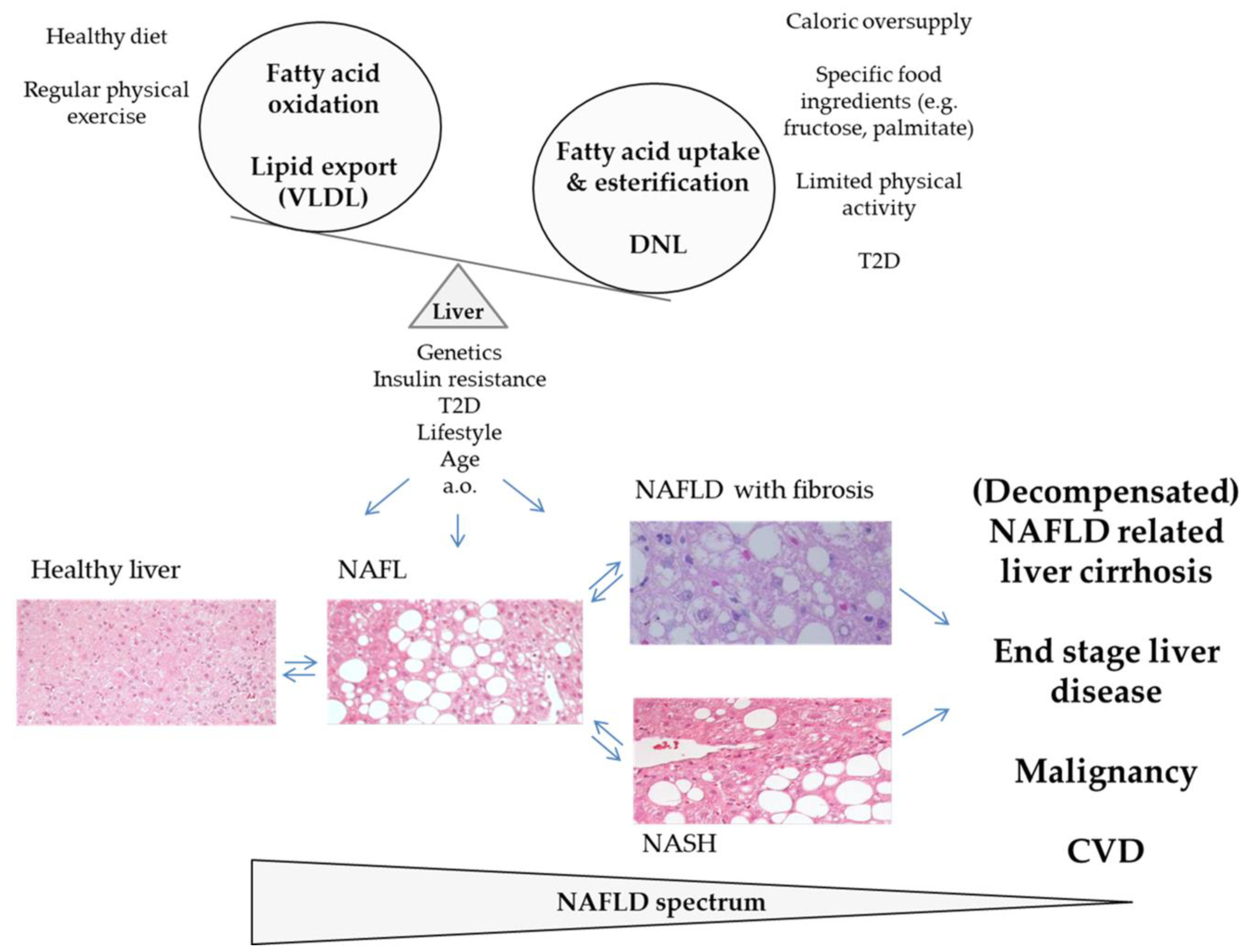 Cells Free Full Text A Narrative Review On The Role Of Ampk On De Novo Lipogenesis In Non Alcoholic Fatty Liver Disease Evidence From Human Studies Html