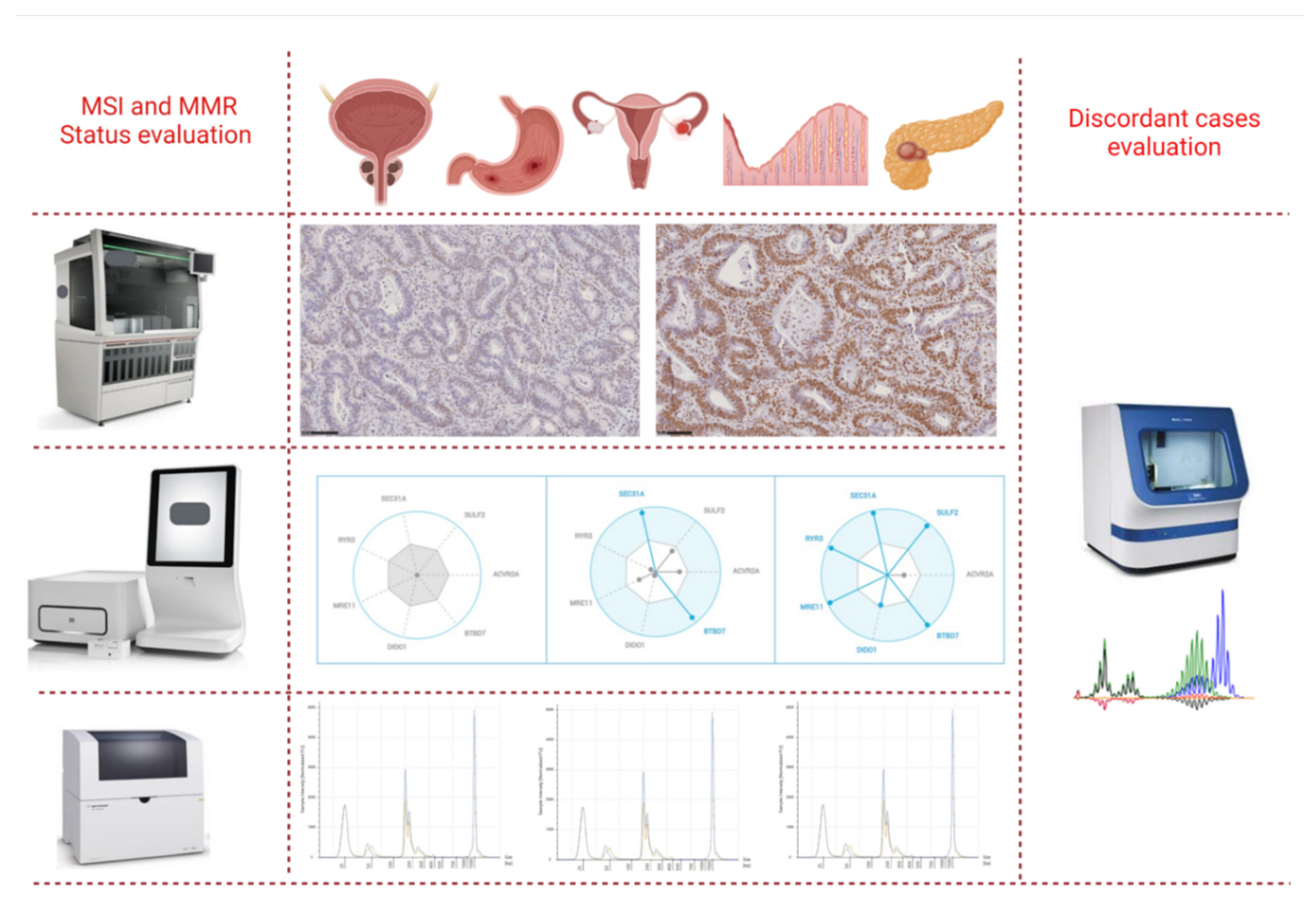 Cells | Free Full-Text | Evaluation of Micro Satellite Instability and  Mismatch Repair Status in Different Solid Tumors: A Multicenter Analysis in  a Real World Setting