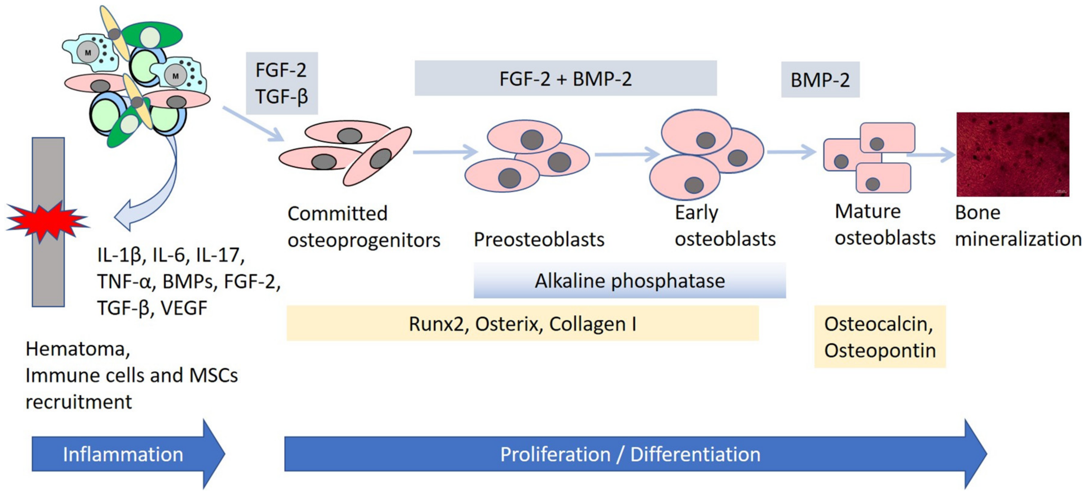 Cells | Free Full-Text | Mesenchymal Stem Cells, Bioactive Factors, and  Scaffolds in Bone Repair: From Research Perspectives to Clinical Practice |  HTML