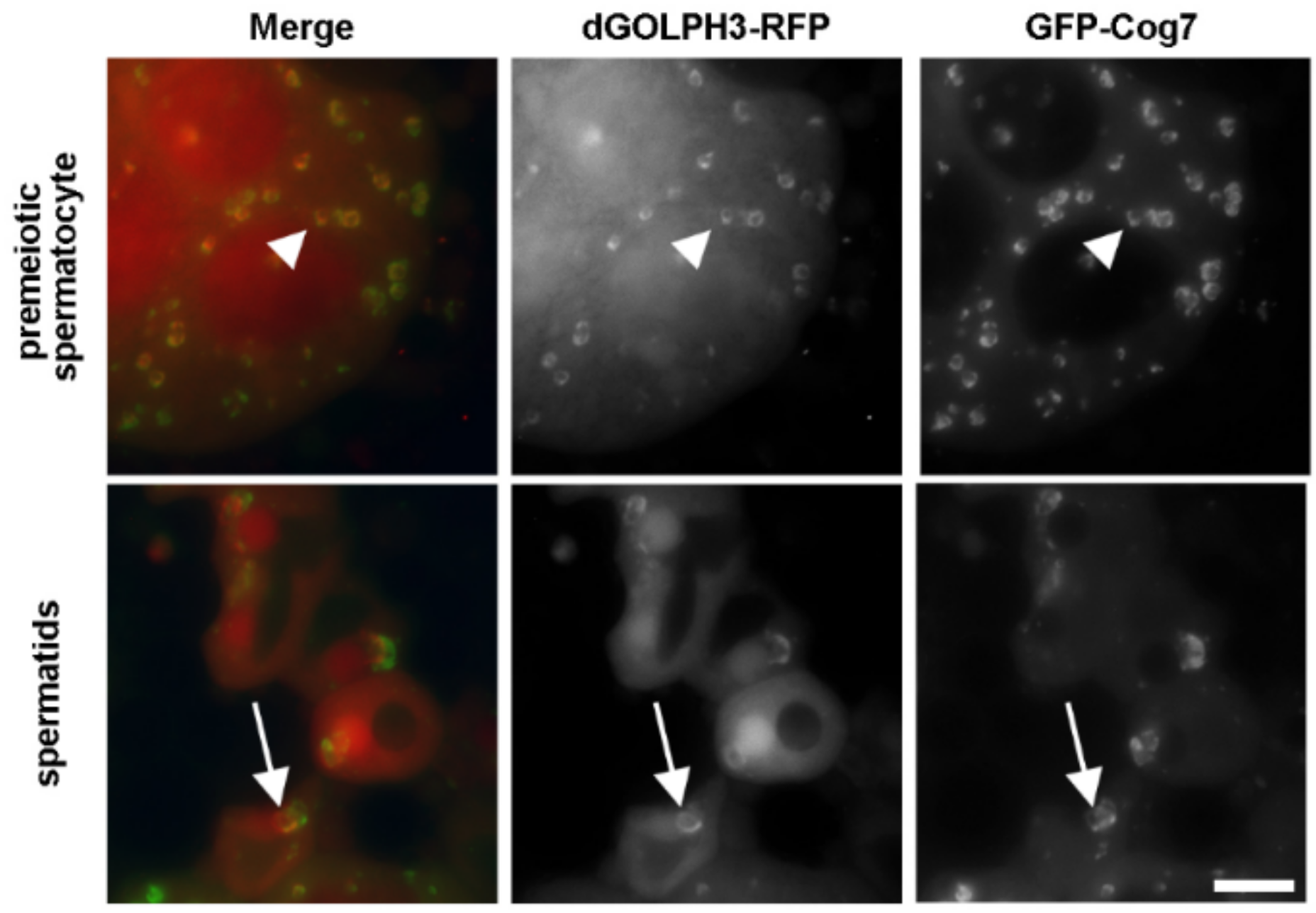Cells | Free Full-Text | Identification of GOLPH3 Partners in Drosophila  Unveils Potential Novel Roles in Tumorigenesis and Neural Disorders