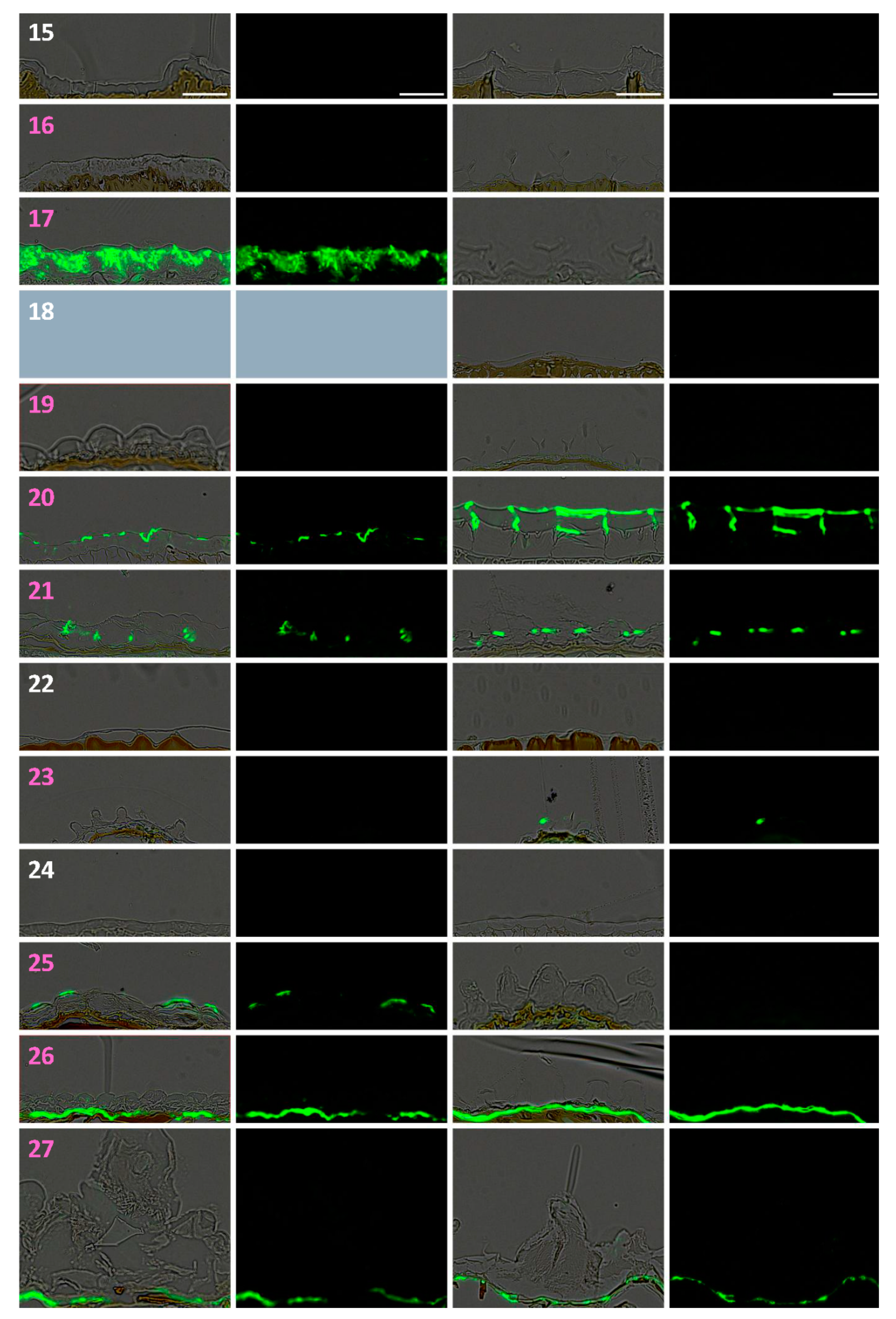 Cells 10 02470 g006b