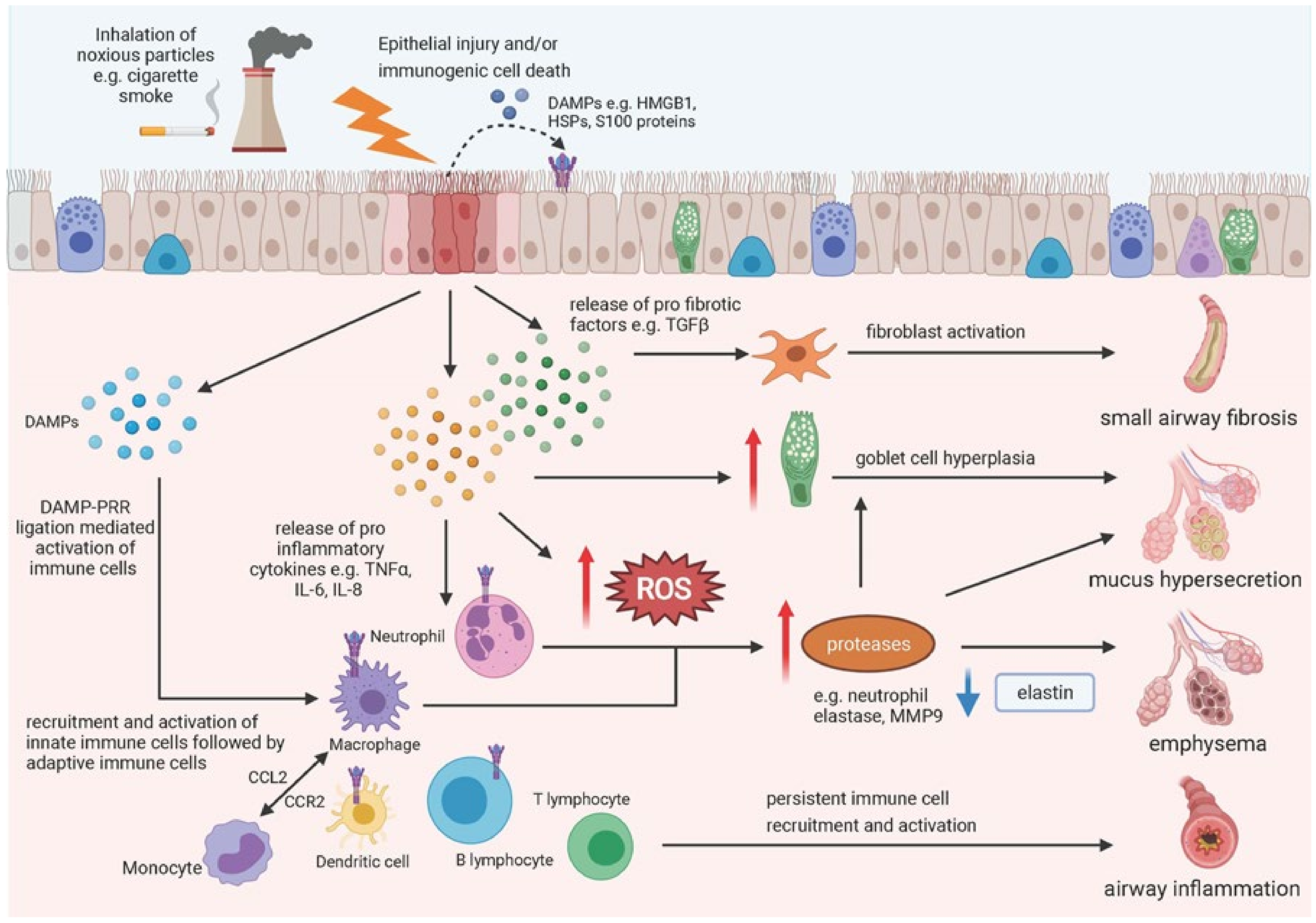 Cells | Free Full-Text | The Role of Epithelial Damage in the Pulmonary  Immune Response