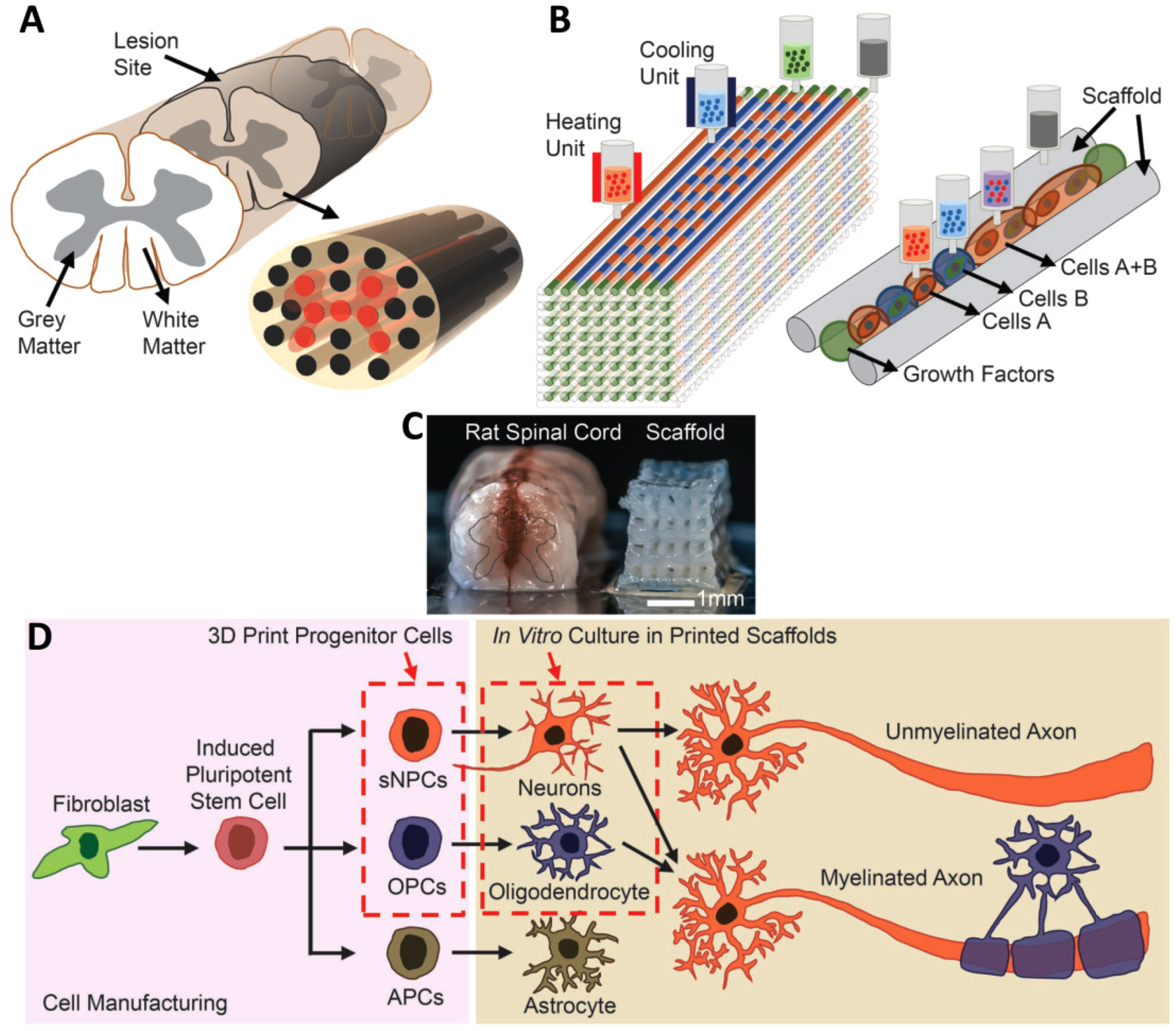 Cells | Free Full-Text | Spinal Cord Injury Management through the  Combination of Stem Cells and Implantable 3D Bioprinted Platforms
