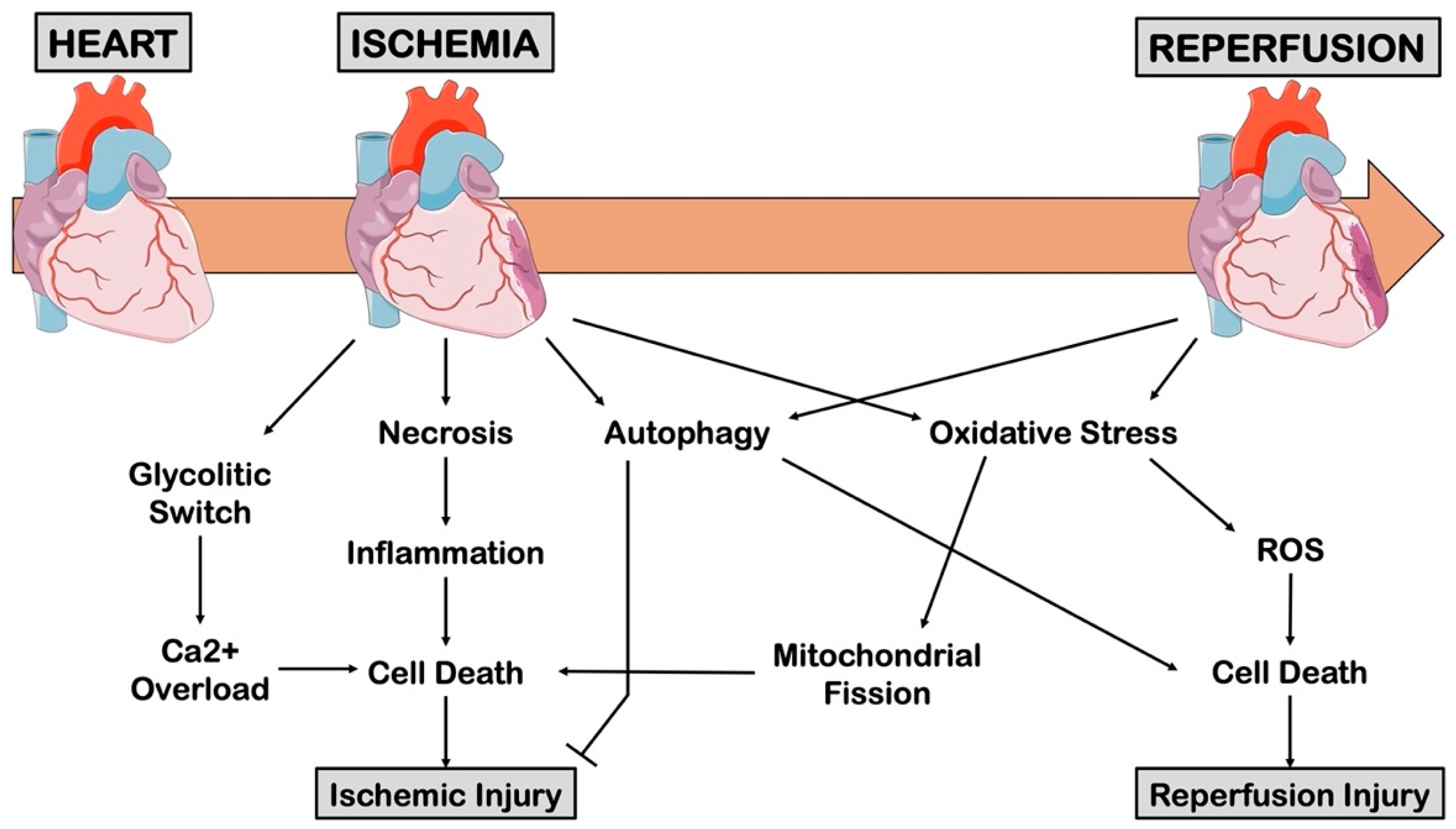 Cells | Free Full-Text | An Overview of the Molecular Mechanisms Associated  with Myocardial Ischemic Injury: State of the Art and Translational  Perspectives