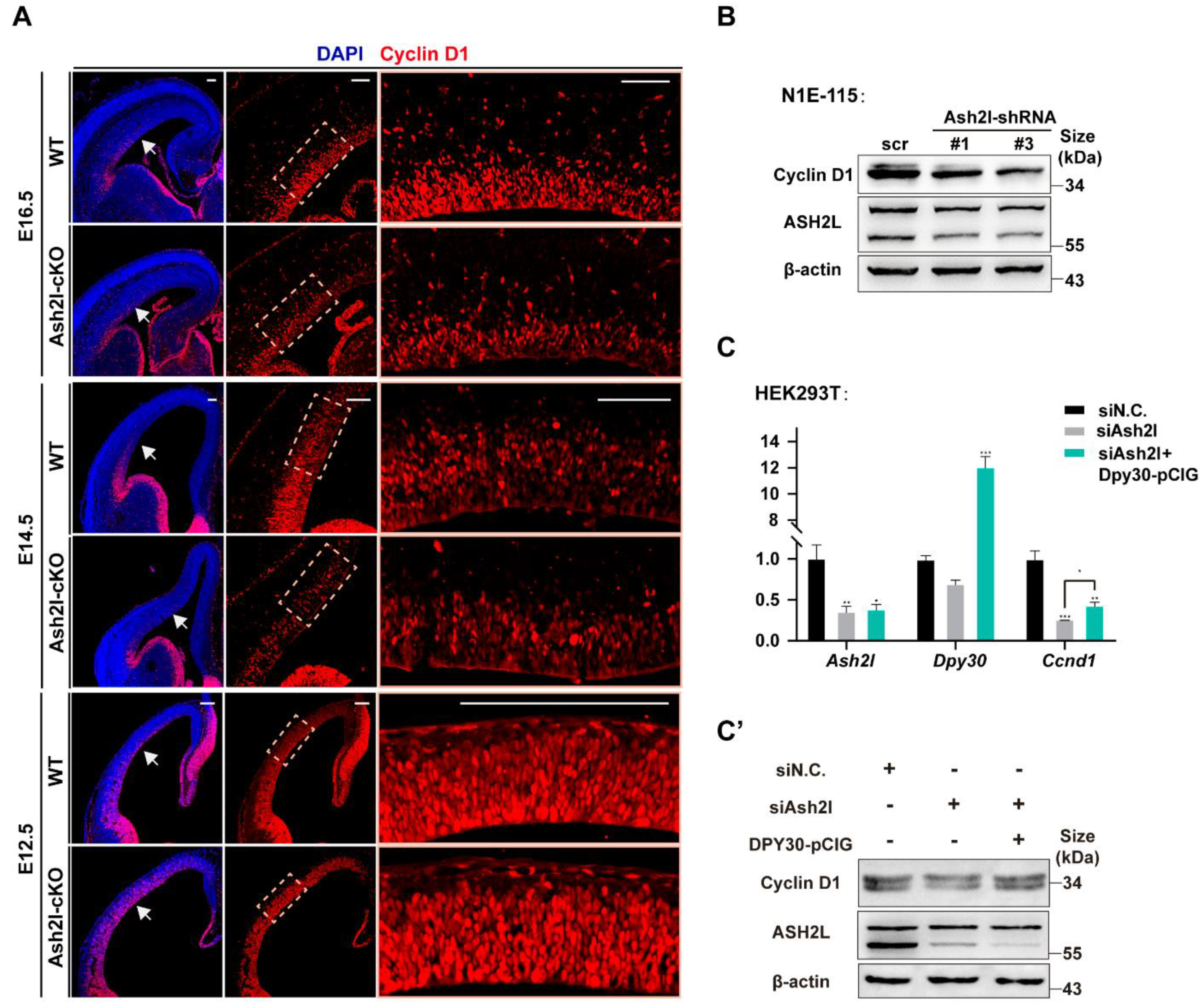 ash2l corticogenesis cell reports