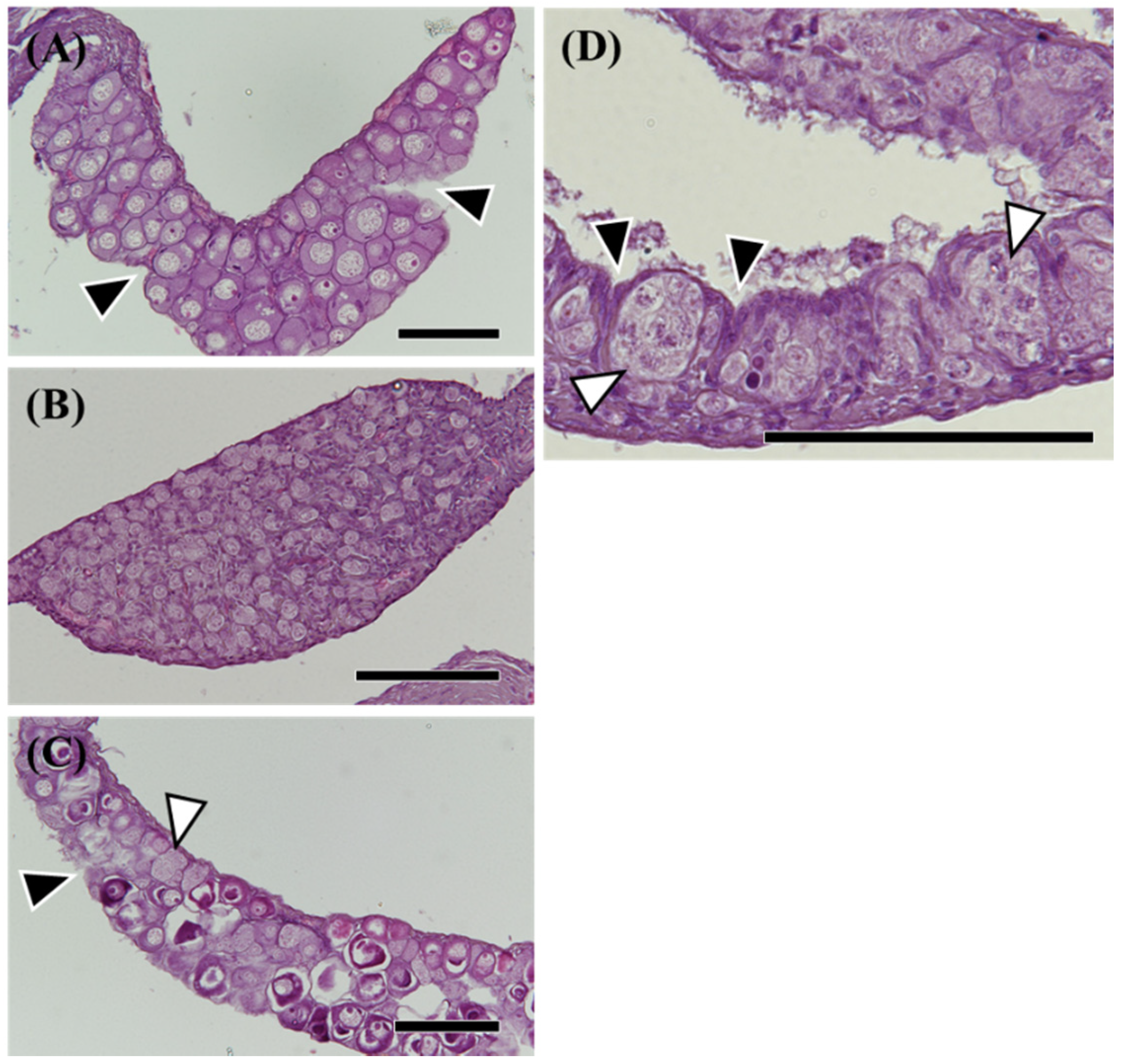 Cells | Free Full-Text | Morphological and Molecular Gonadal Sex  Differentiation in the Wild Japanese eel Anguilla japonica