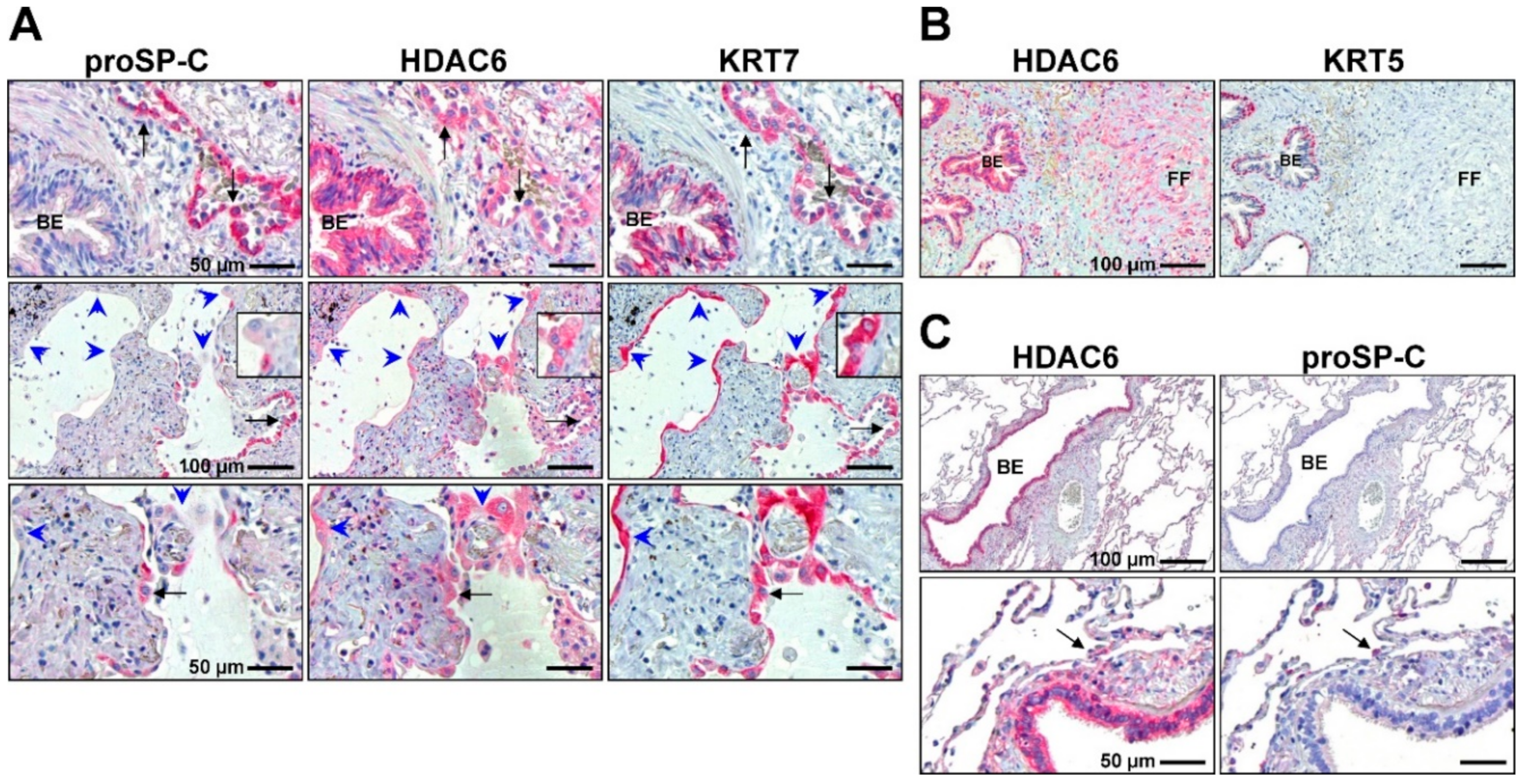 Cells | Free Full-Text | Targeting Histone Deacetylases in Idiopathic  Pulmonary Fibrosis: A Future Therapeutic Option