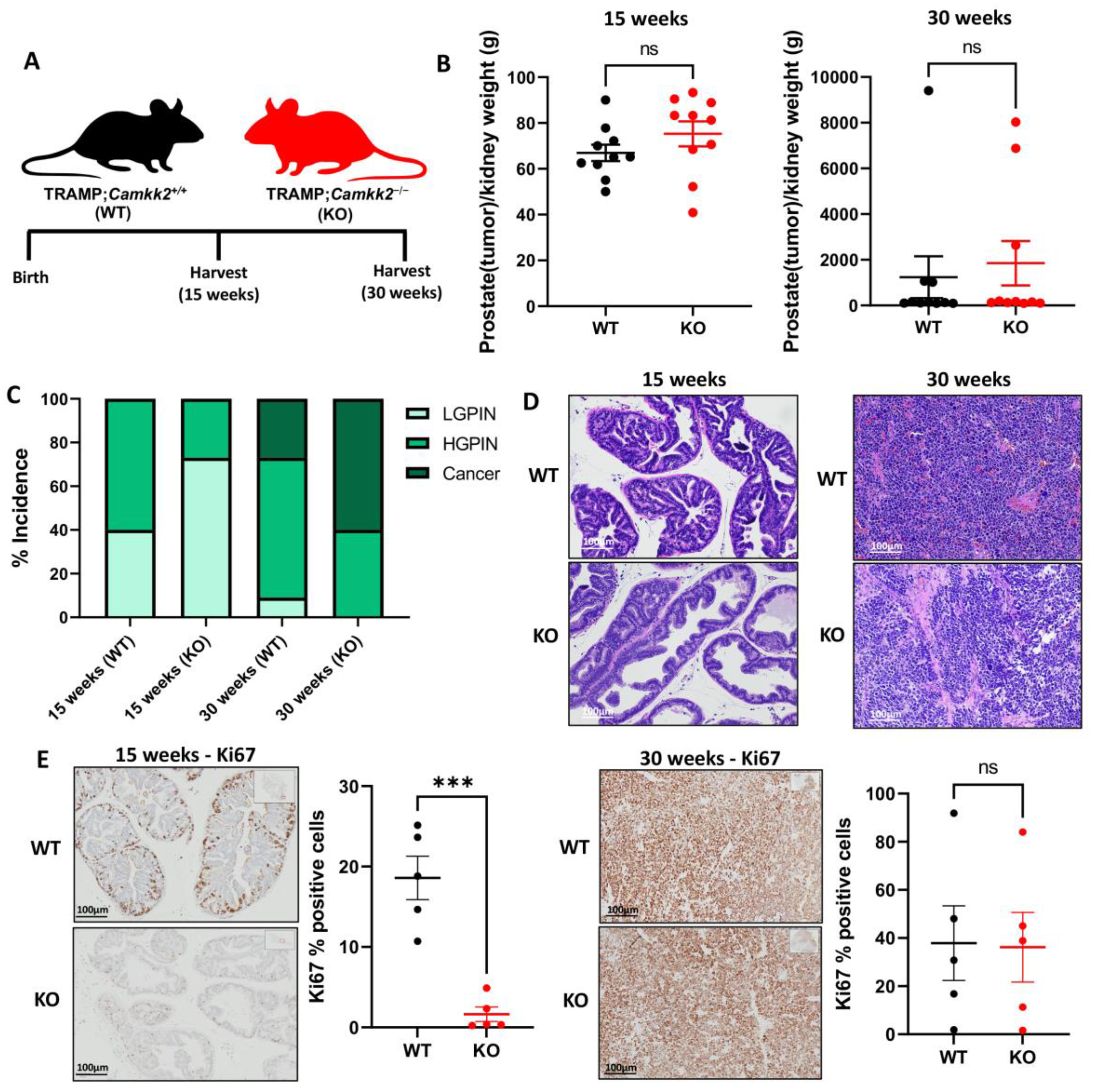 Cells | Free Full-Text | Systemic Ablation of Camkk2 Impairs Metastatic  Colonization and Improves Insulin Sensitivity in TRAMP Mice: Evidence for  Cancer Cell-Extrinsic CAMKK2 Functions in Prostate Cancer