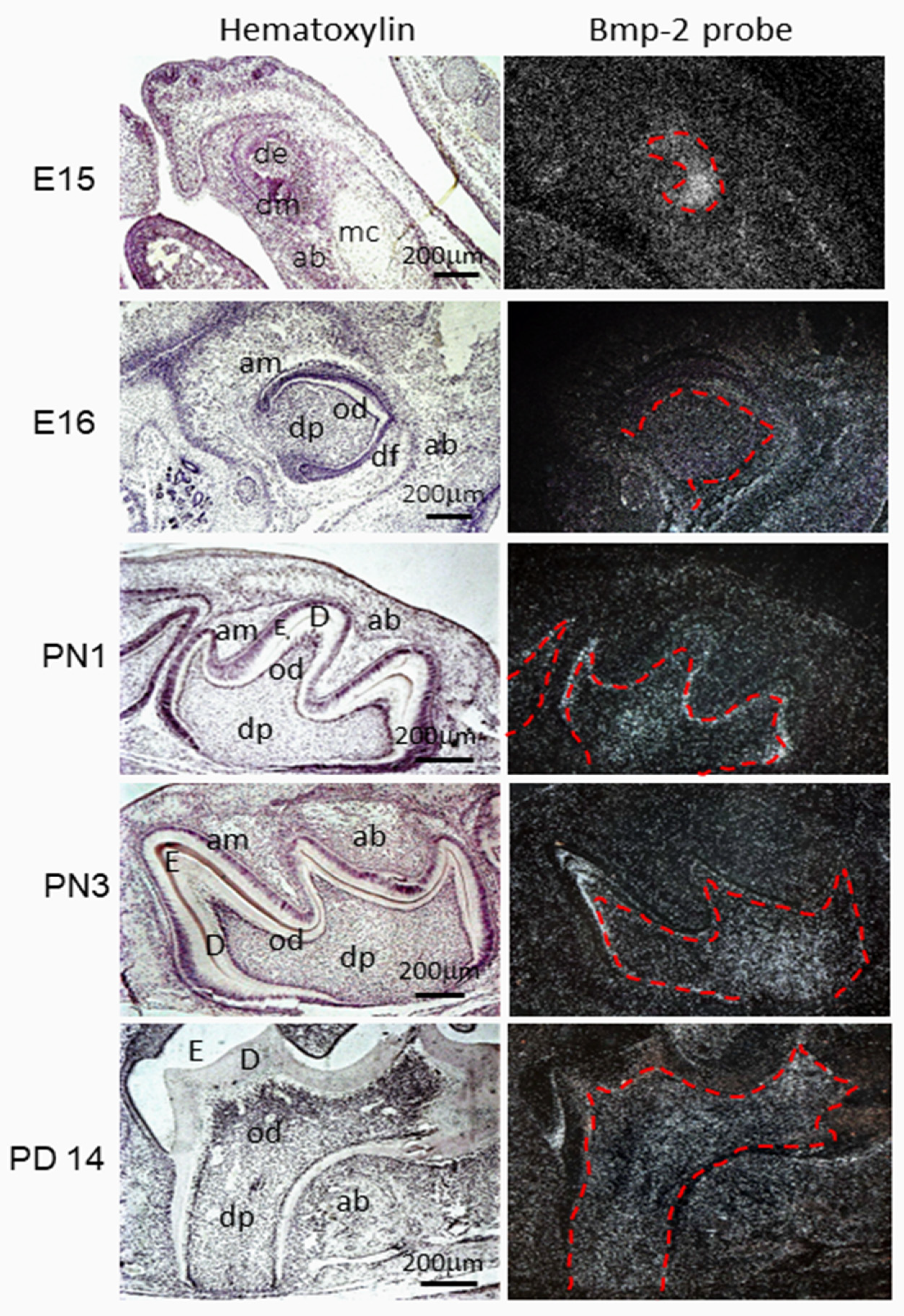 Mesenchymal condensation in tooth development and regeneration: a