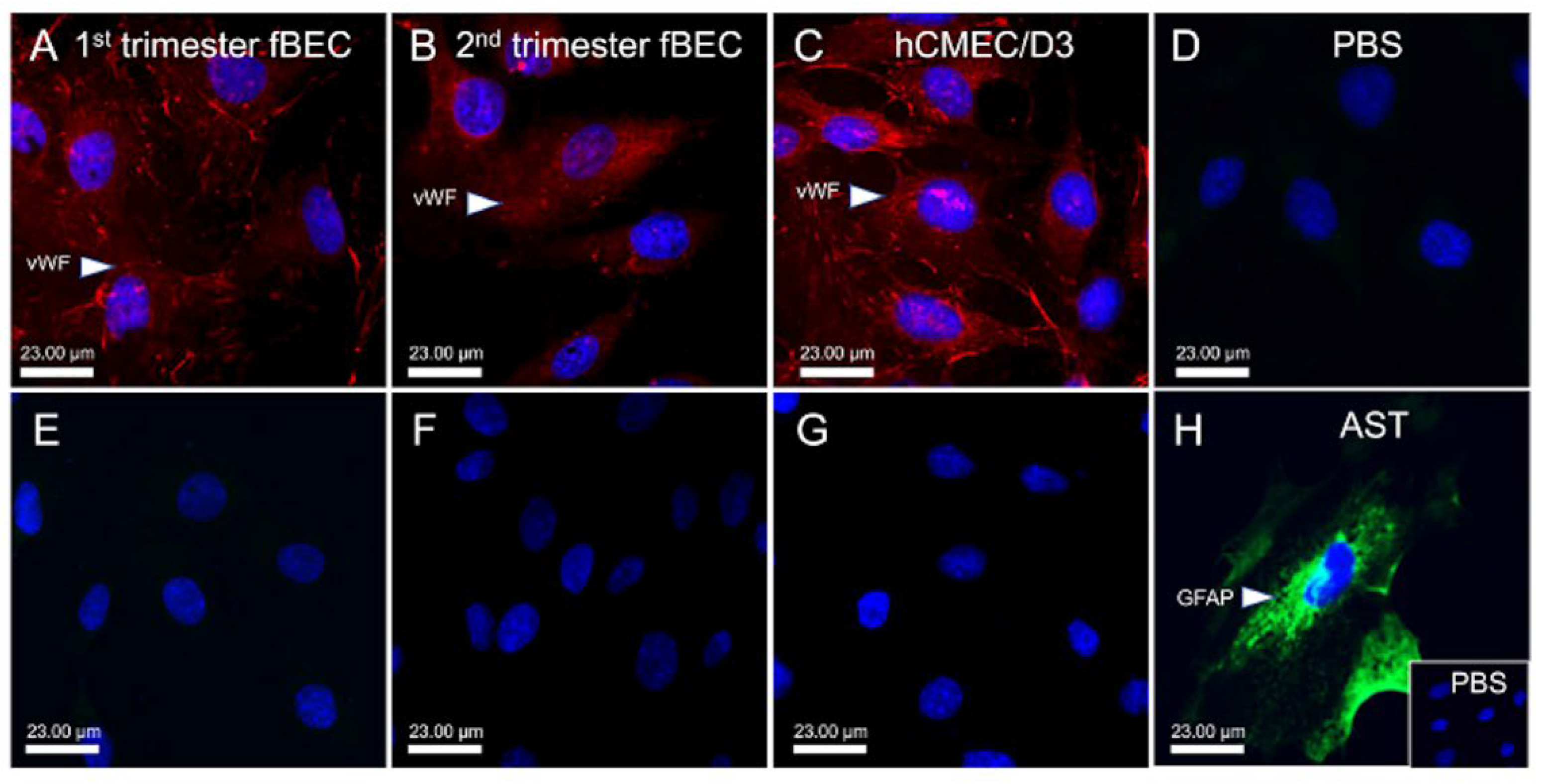 Cells | Free Full-Text | Functional Expression of Multidrug-Resistance  (MDR) Transporters in Developing Human Fetal Brain Endothelial Cells | HTML