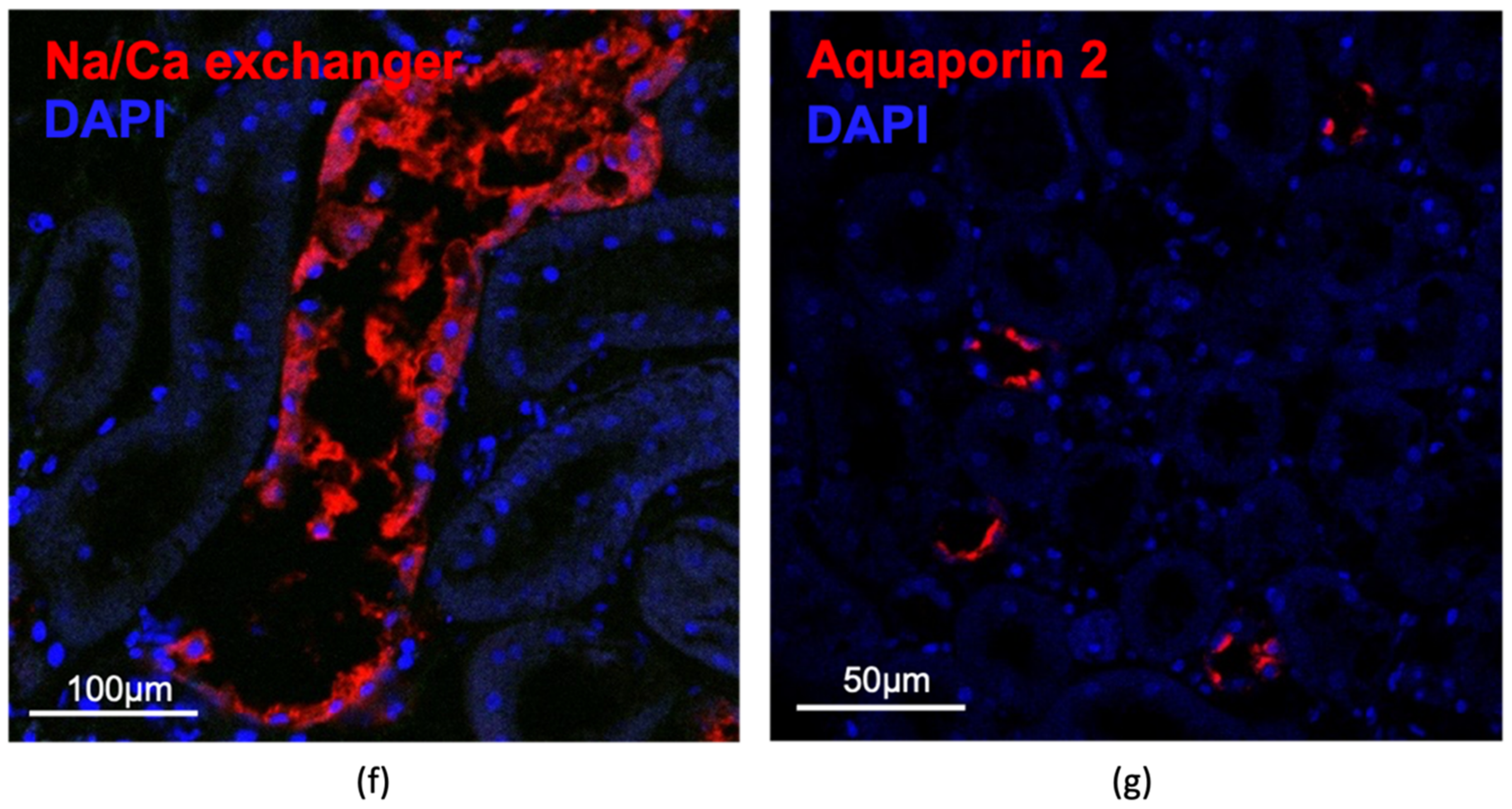 Cells Free Full Text A 3d In Vivo Model For Studying Human Renal Cystic Tissue And Mouse Kidney Slices Html