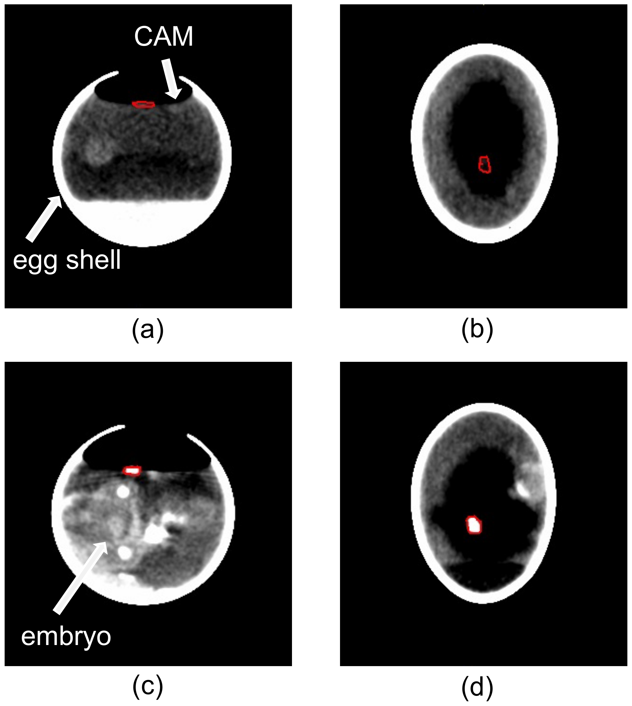 Cells Free Full Text A 3d In Vivo Model For Studying Human Renal Cystic Tissue And Mouse Kidney Slices Html