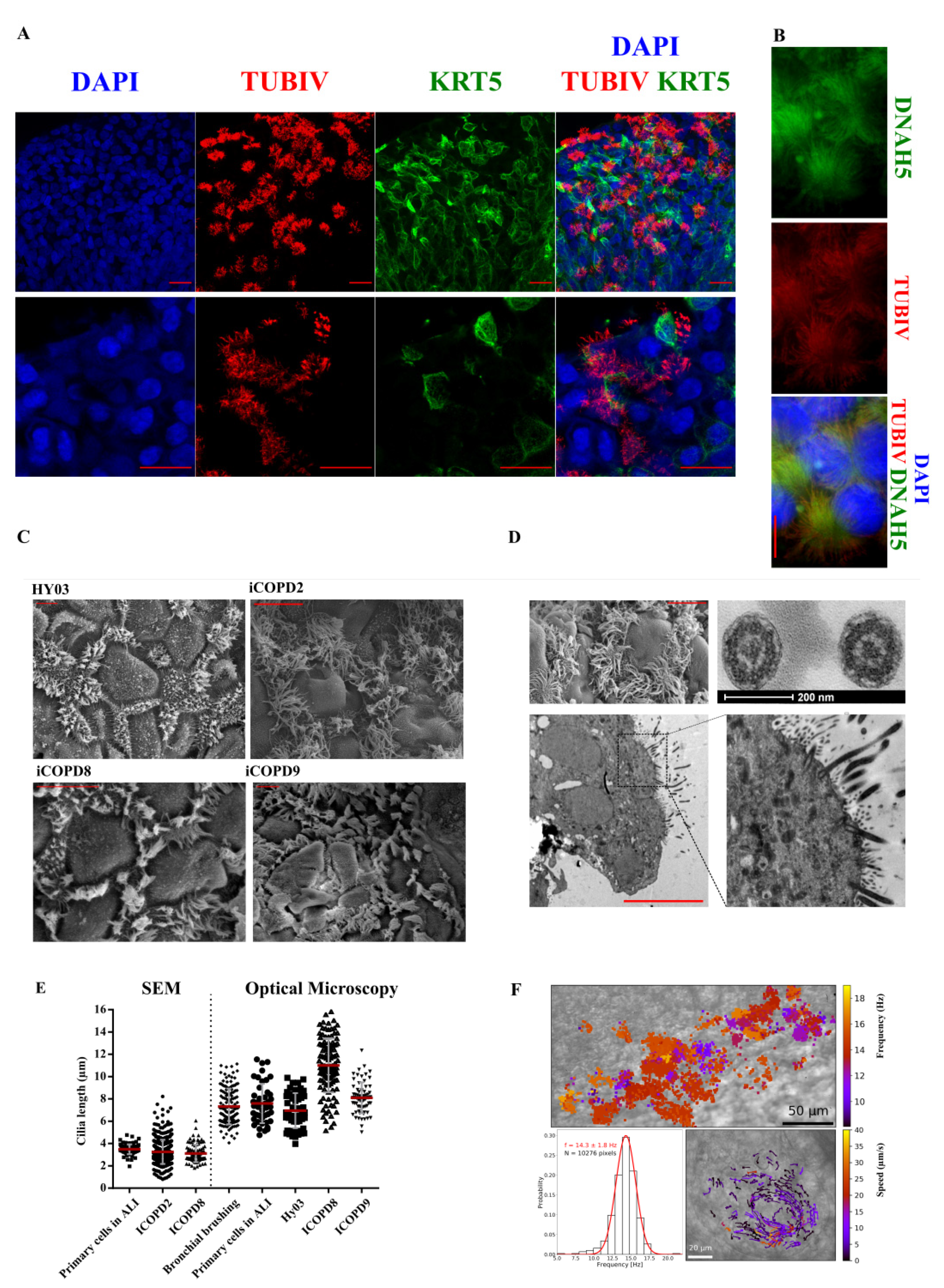 Cells | Free Full-Text | Differentiation of Human Induced Pluripotent Stem  Cells from Patients with Severe COPD into Functional Airway Epithelium |  HTML