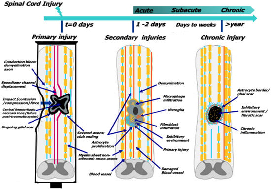 Non-traumatic spinal cord compression and driving