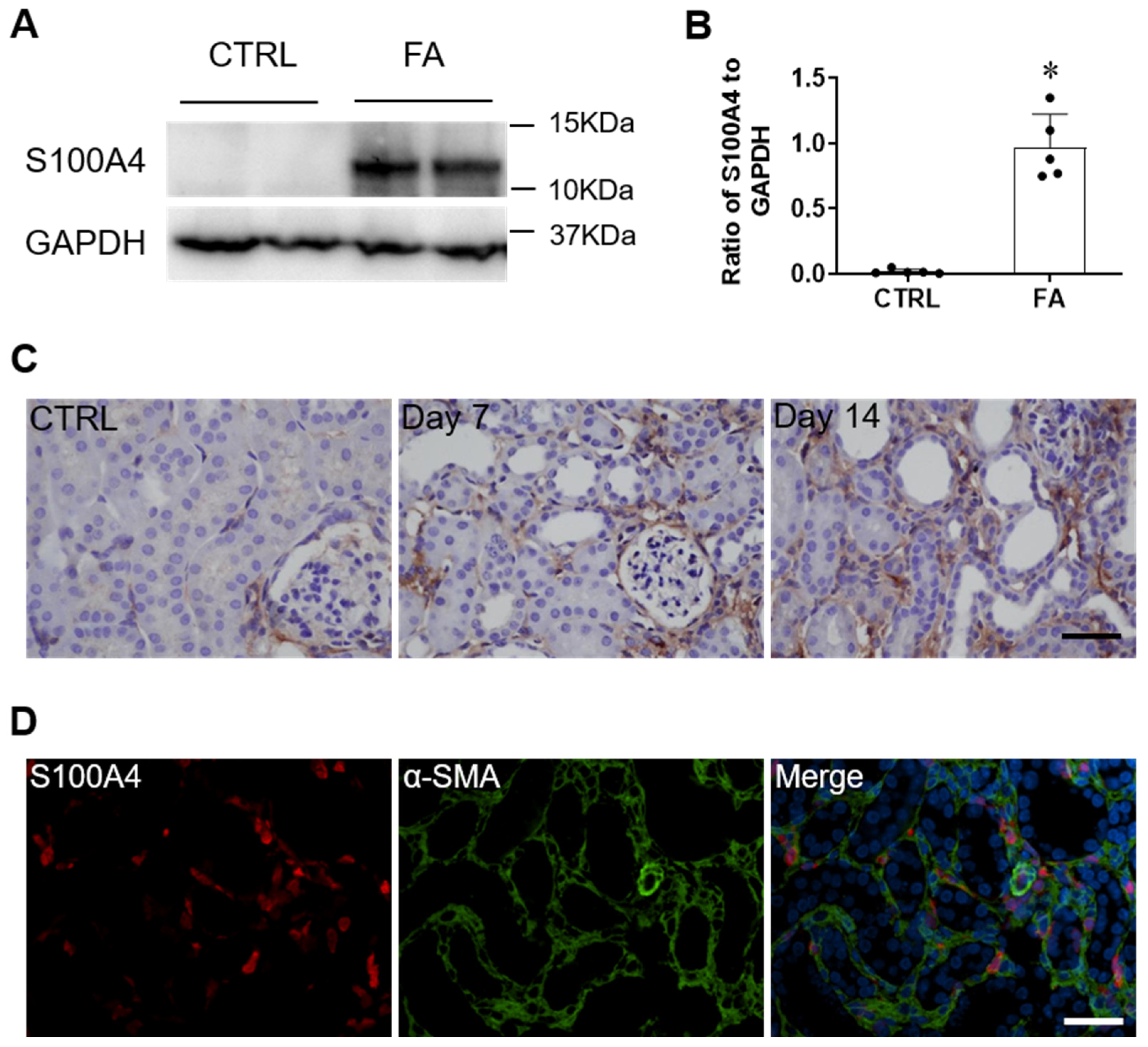 Cells | Free Full-Text | Pharmacological Inhibition of S100A4