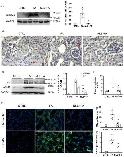 Cells | Free Full-Text | Pharmacological Inhibition of S100A4