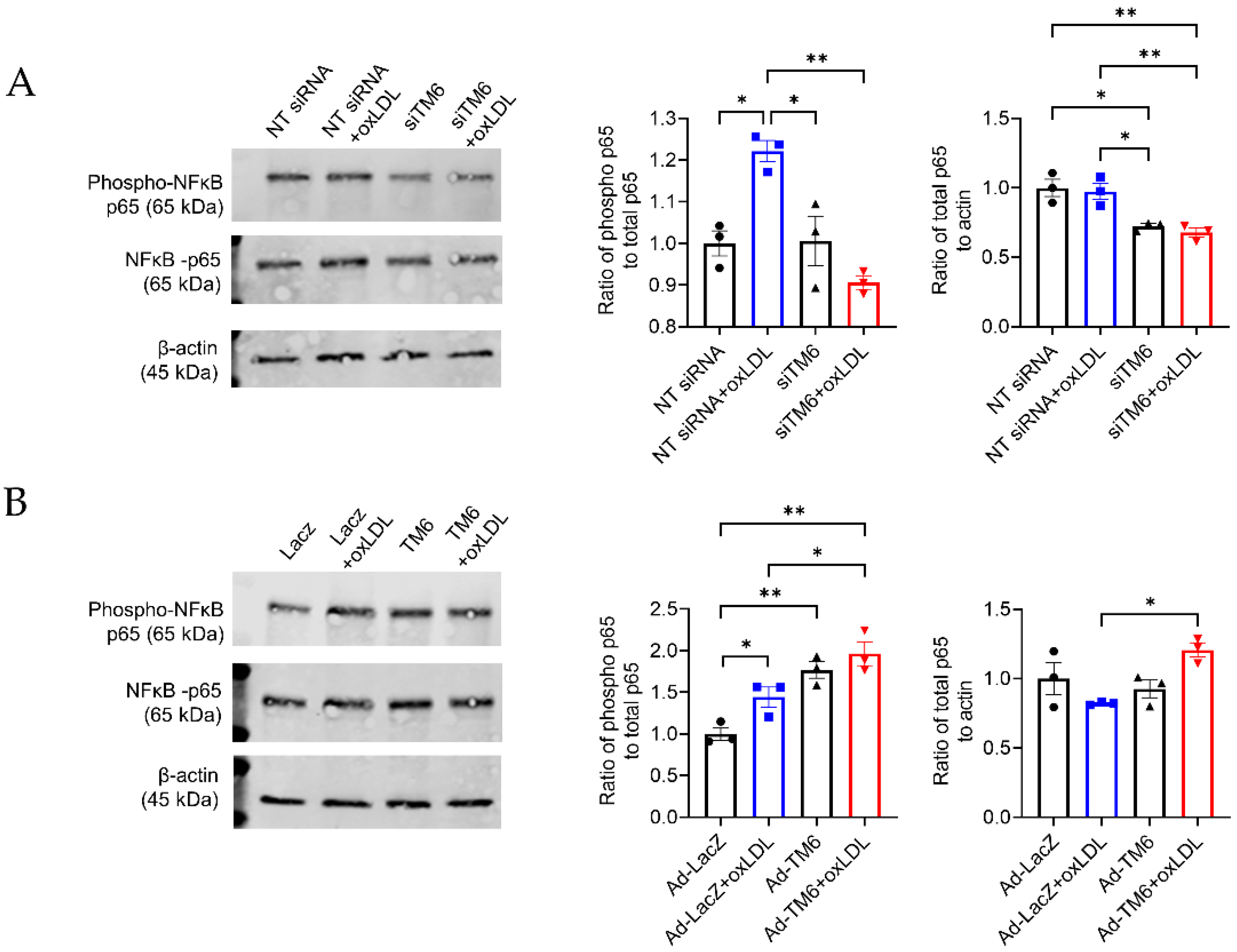 Cells | Free Full-Text | Myeloid TM6SF2 Deficiency Inhibits 