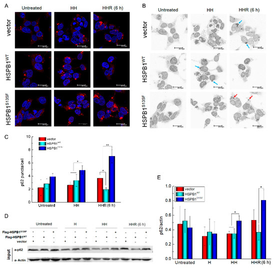 Cells | Free Full-Text | A Charcot-Marie-Tooth-Causing Mutation in ...