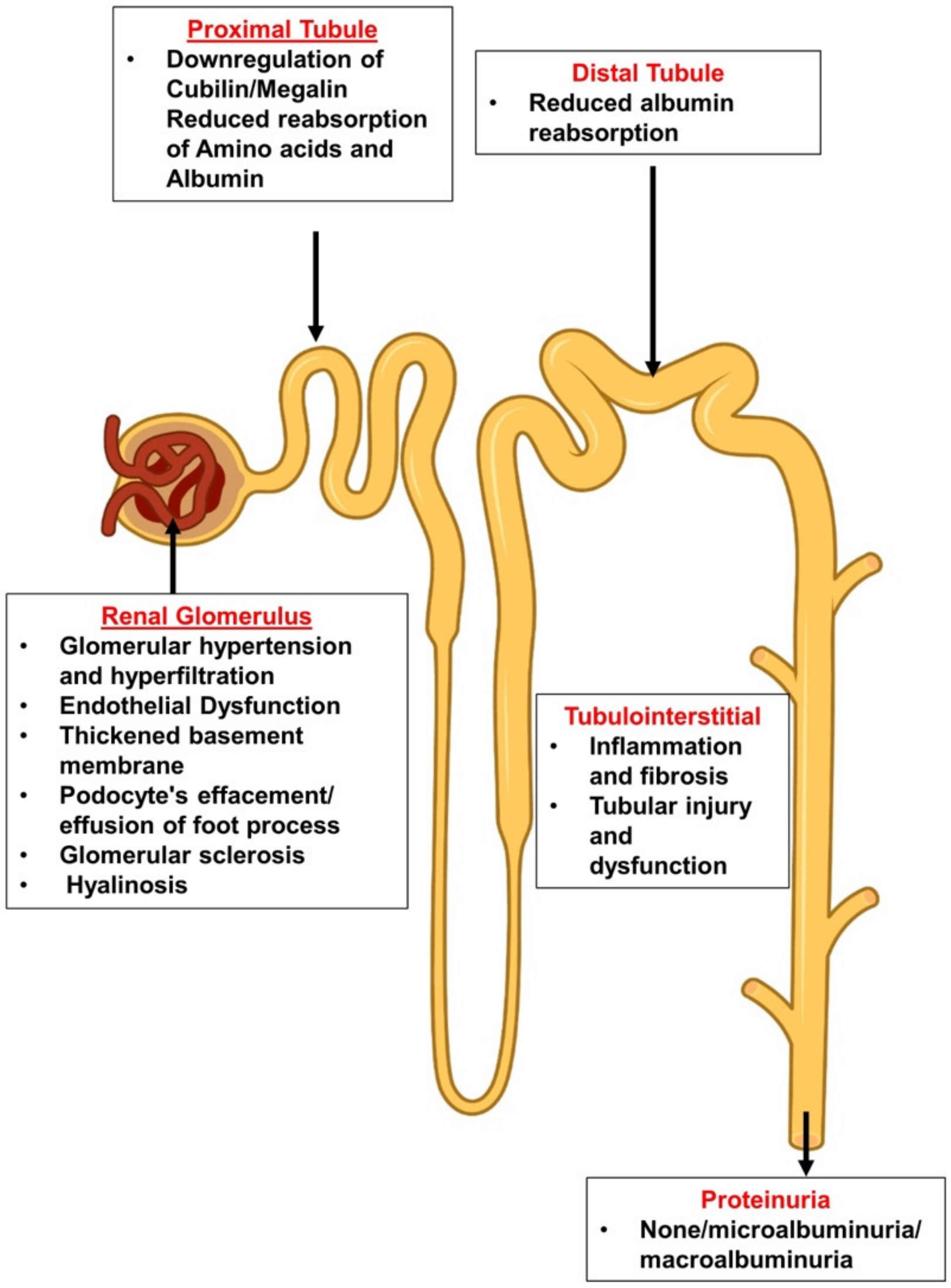 Cells Free FullText Diabetic Proteinuria Revisited Updated