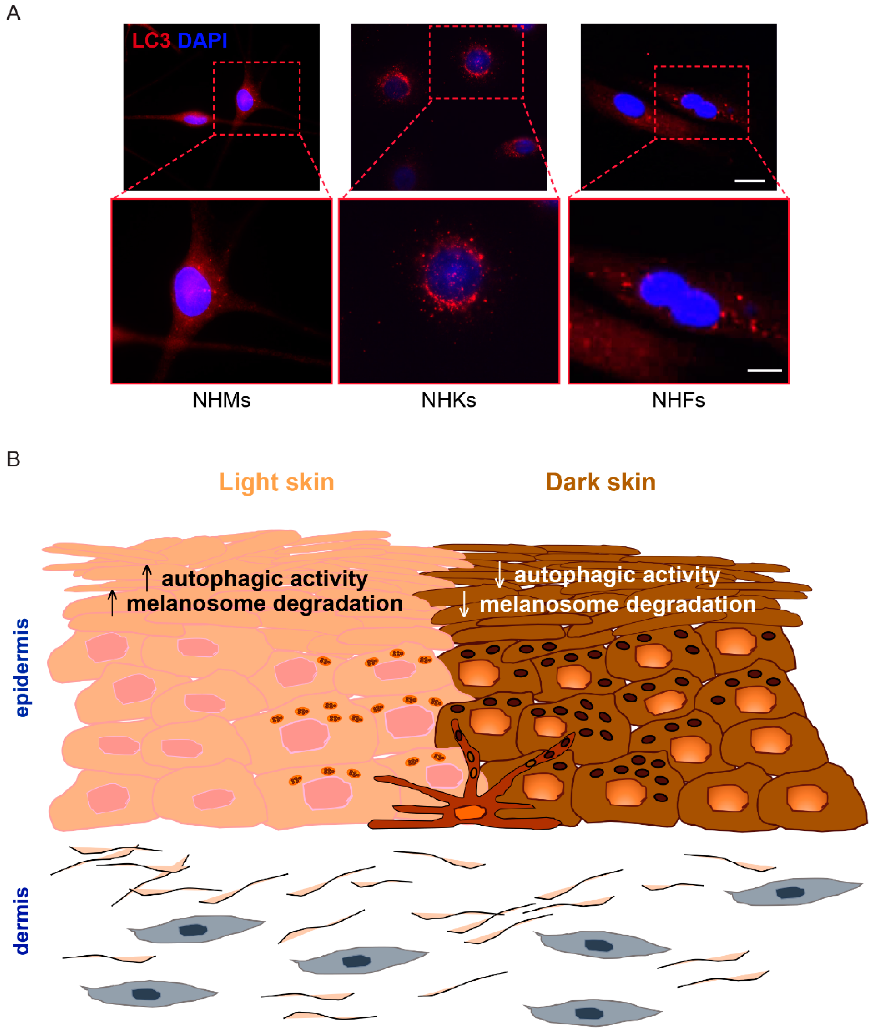 Cells | Free Full-Text | Shining Light on Autophagy in Skin Pigmentation  and Pigmentary Disorders