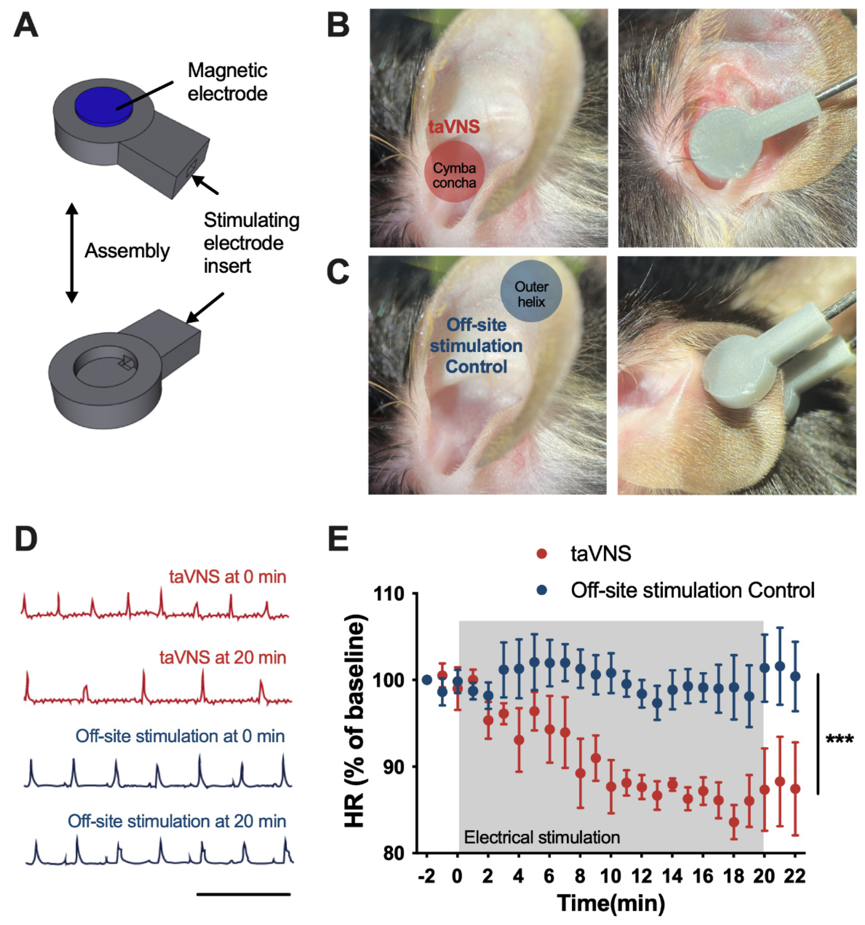 Transcutaneous auricular vagus nerve stimulation as a potential novel  treatment for polycystic ovary syndrome