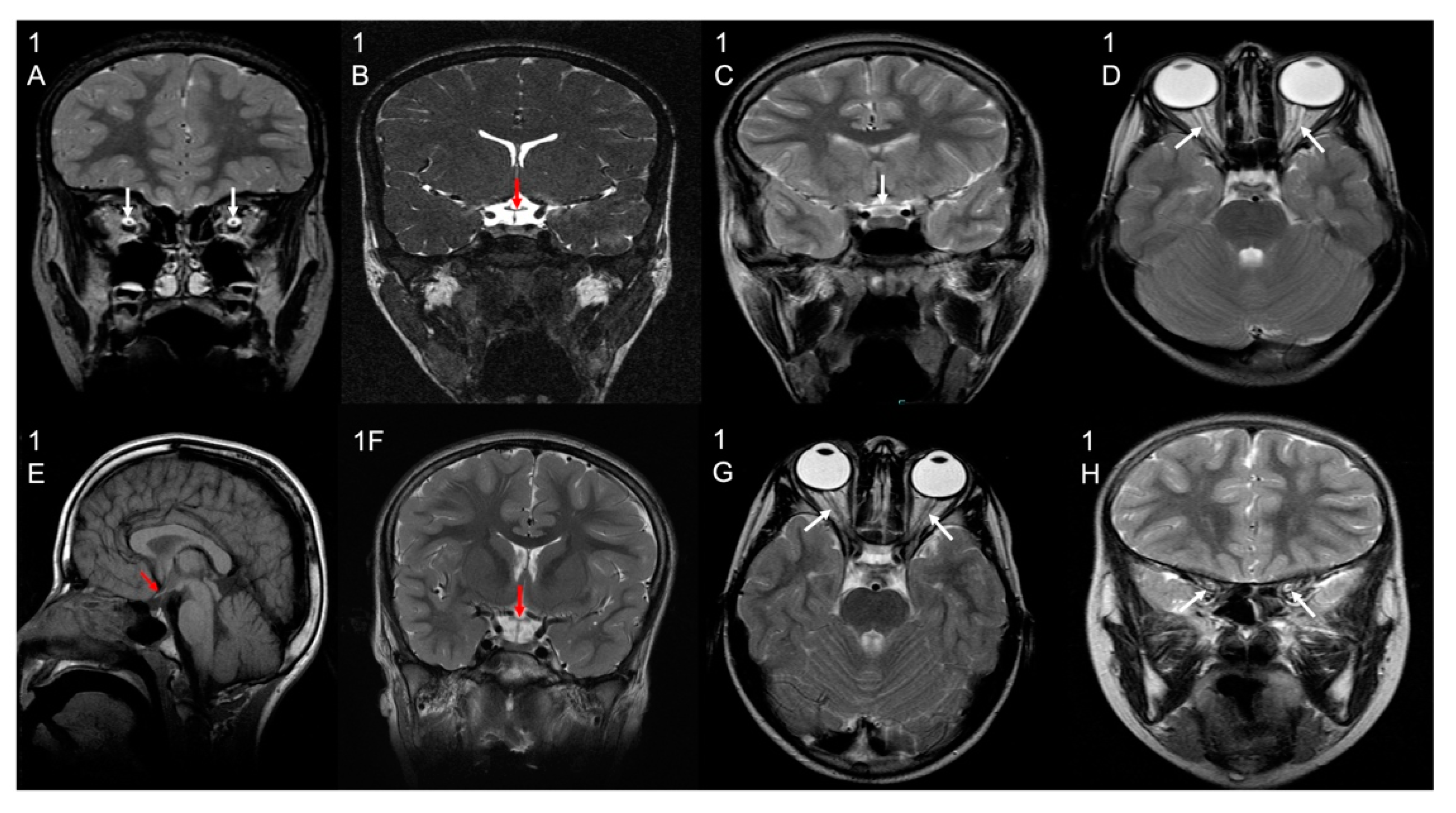Cells 11 03154 g002 Cells 11 03154 g002