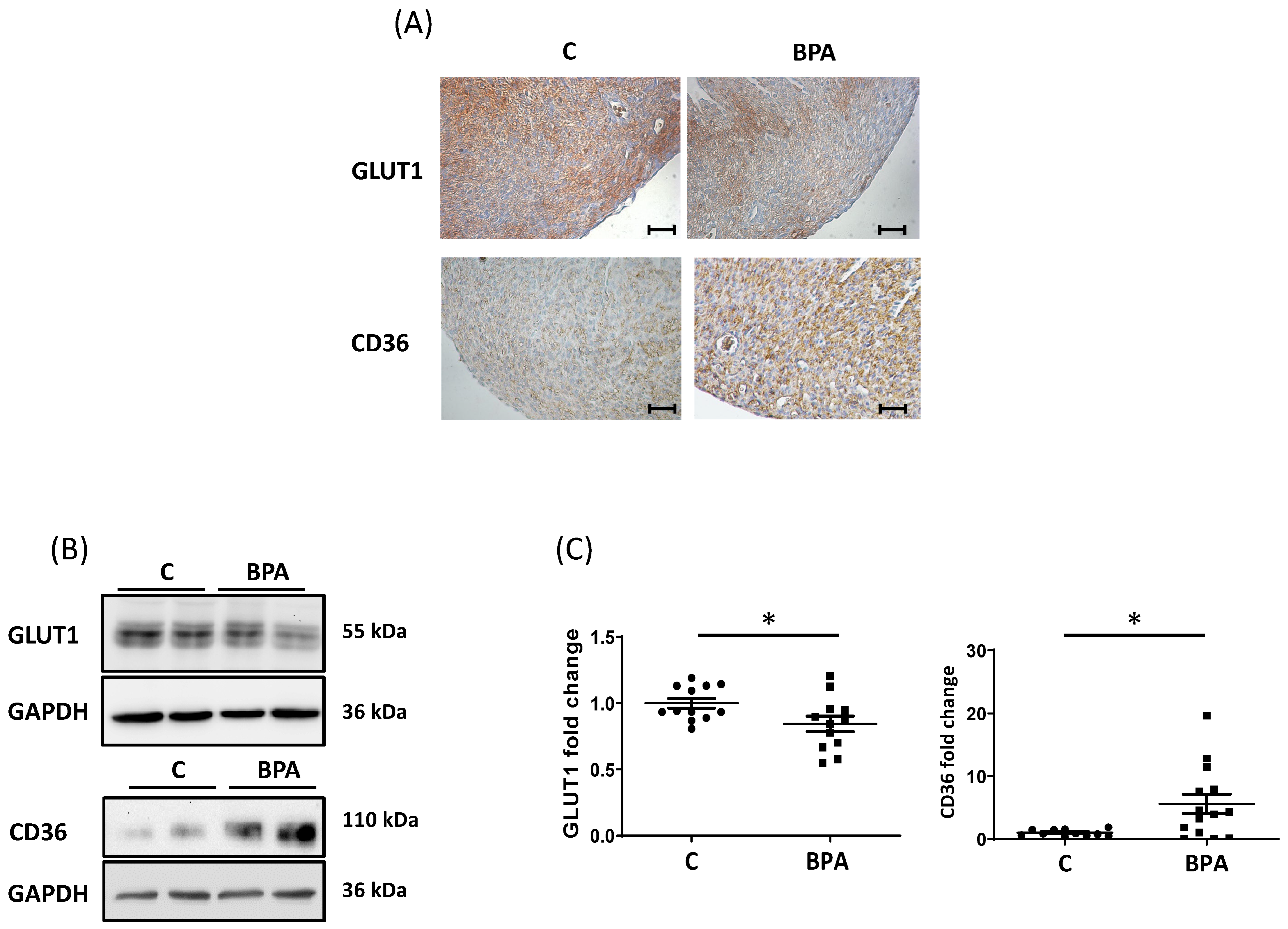 Cells | Free Full-Text | Fetal Myocardial Expression of GLUT1: Roles of BPA  Exposure and Cord Blood Exosomes in a Rat Model