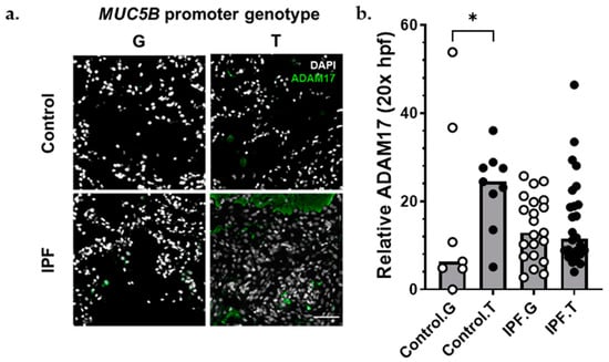 https://www.mdpi.com/cells/cells-11-03319/article_deploy/html/images/cells-11-03319-g005-550.jpg