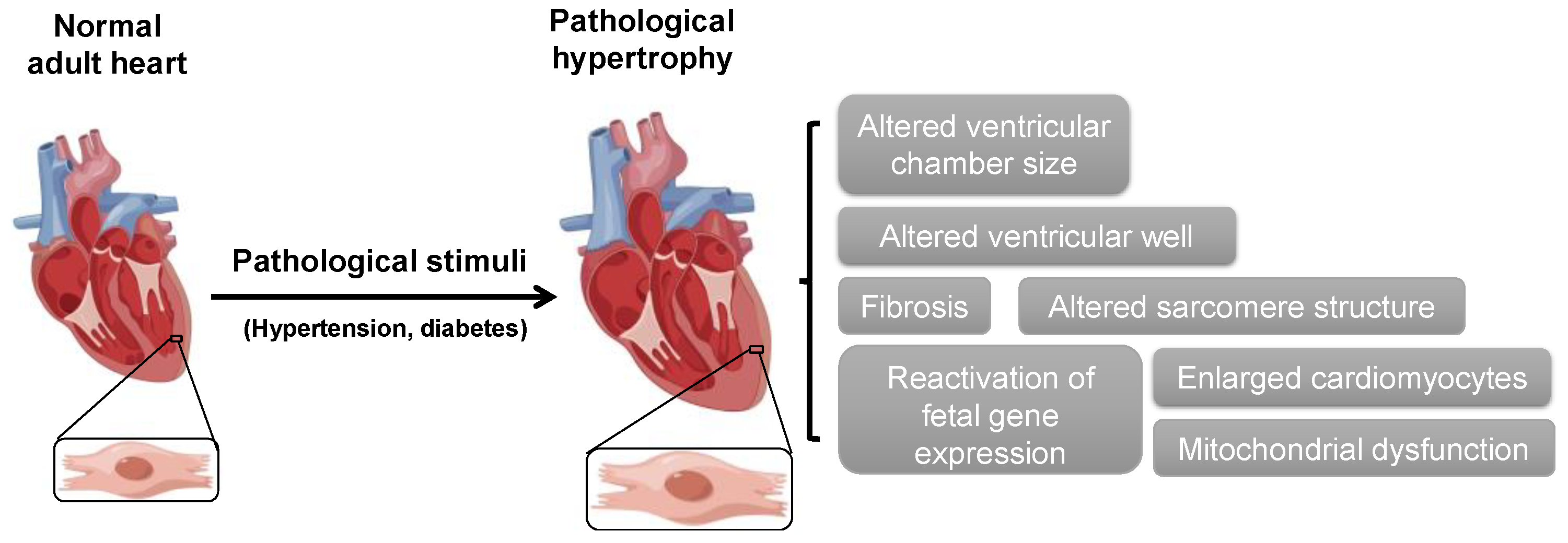 Cells | Free Full-Text | Actin-Binding Proteins in Cardiac Hypertrophy