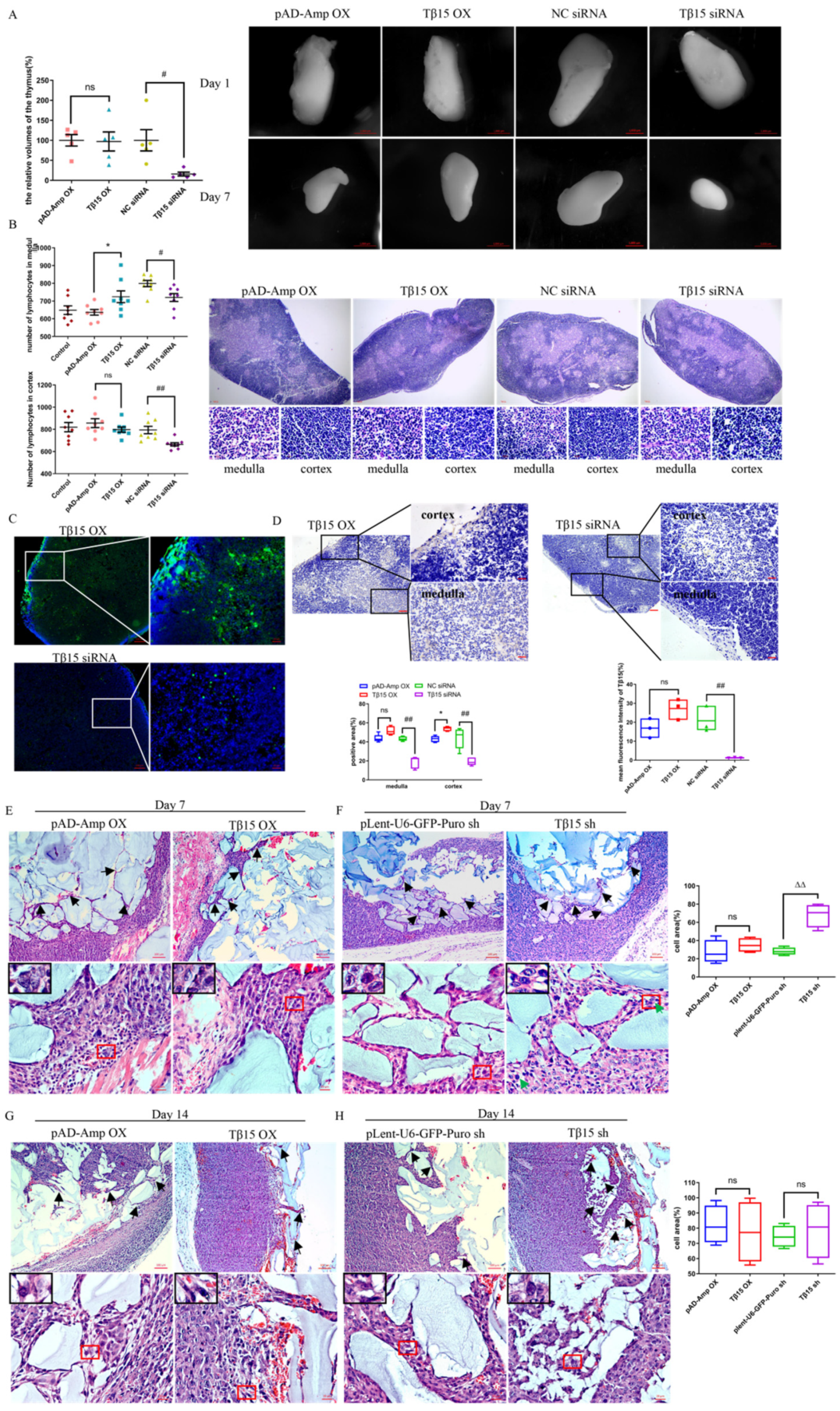 Cells | Free Full-Text | Thymosin Beta 15 Alters the Spatial