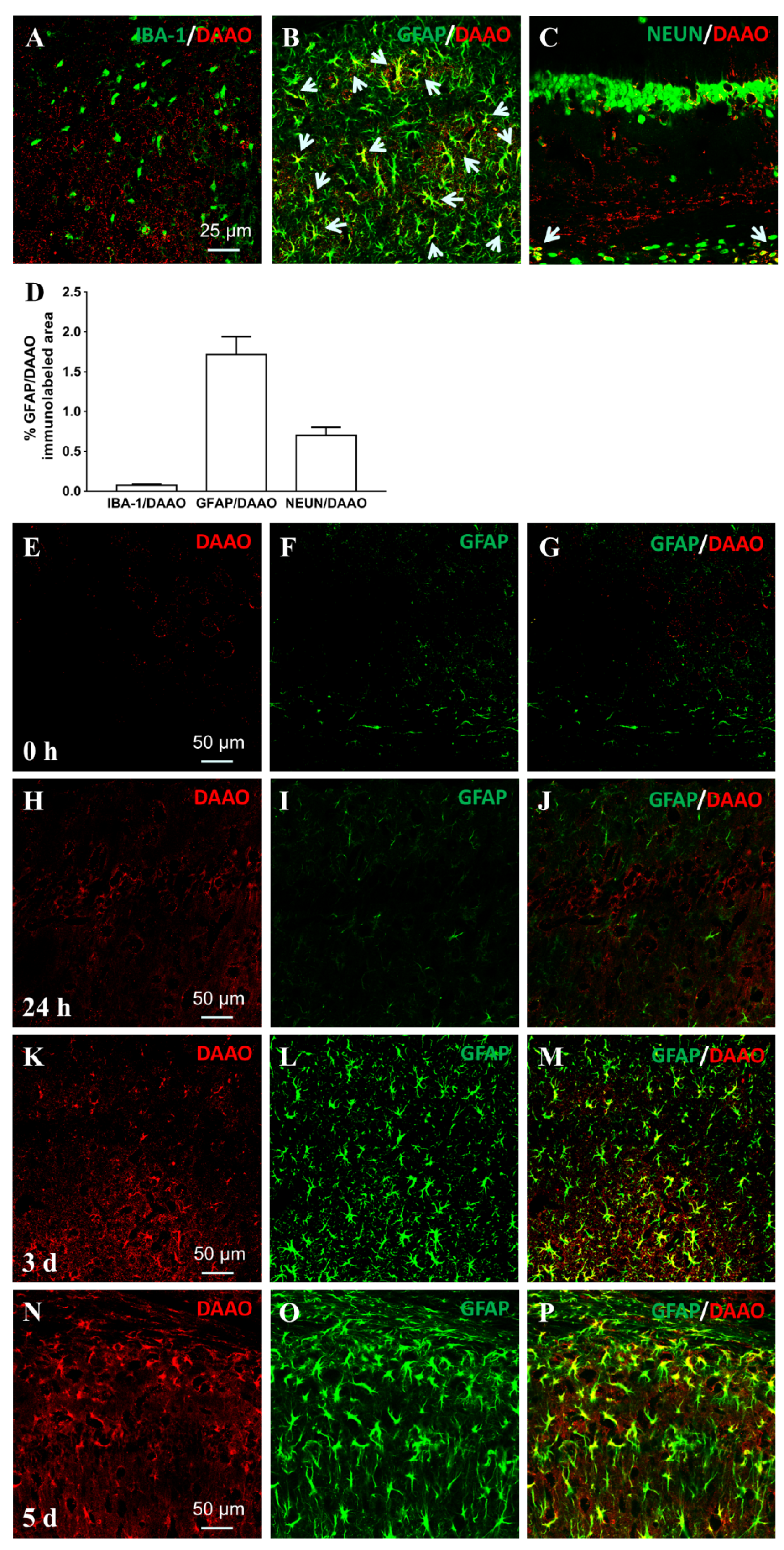 Cells | Free Full-Text | Involvement of DAAO Overexpression in