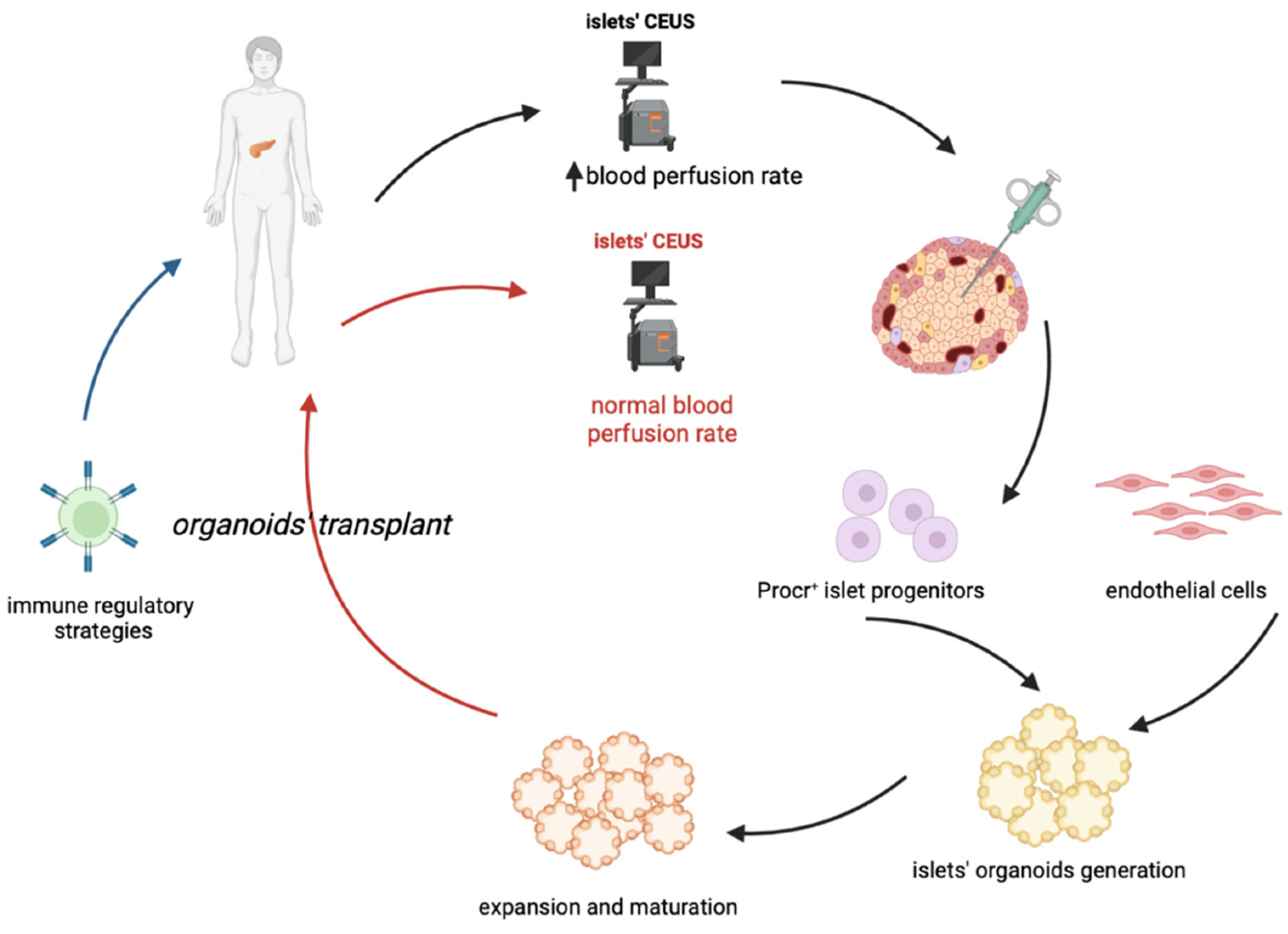 Cells | Free Full-Text | Insulitis in Human Type 1 Diabetic Pancreas: From Stem  Cell Grafting to Islet Organoids for a Successful Cell-Based Therapy