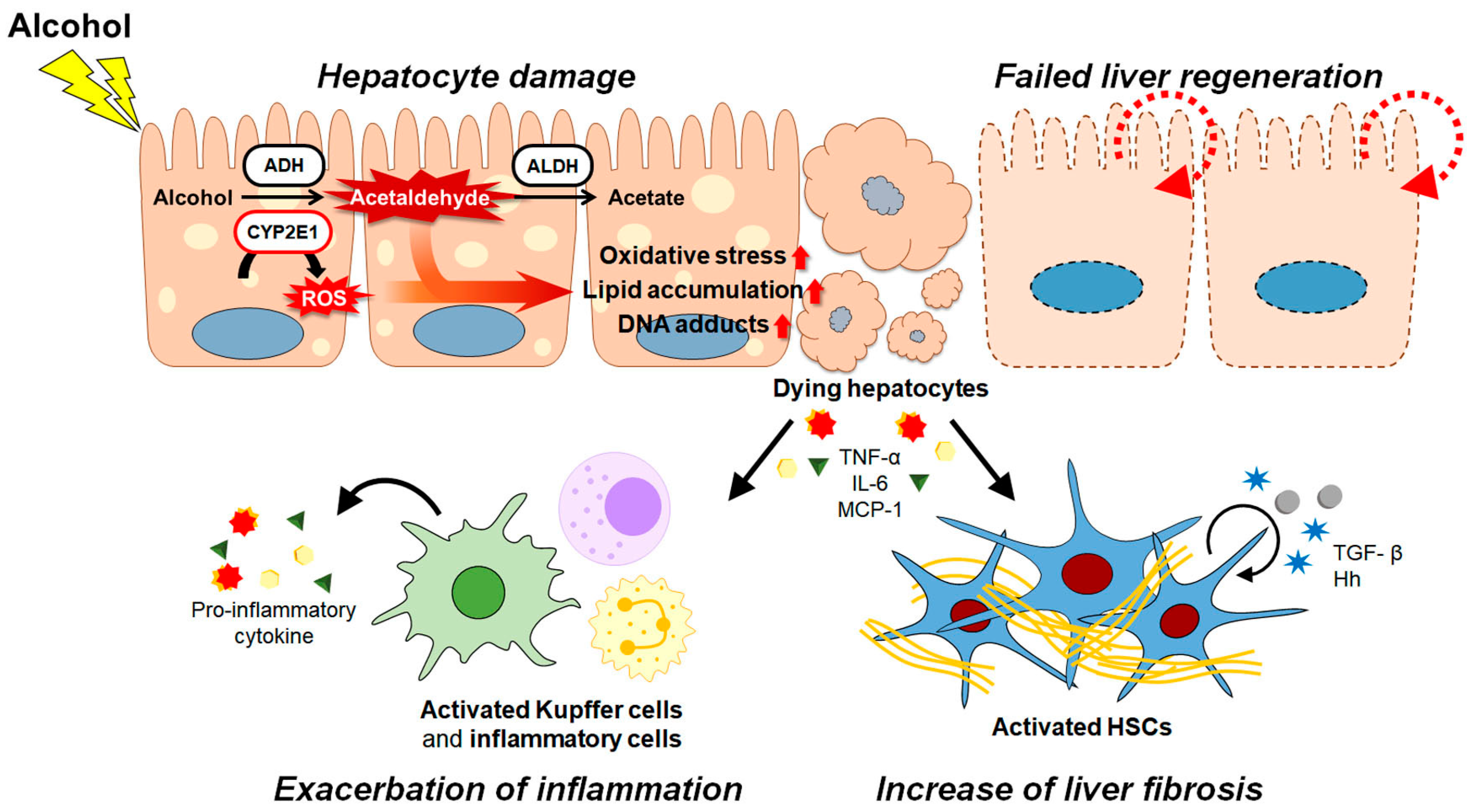 Cells | Free Full-Text | Current Therapeutic Options and Potential of  Mesenchymal Stem Cell Therapy for Alcoholic Liver Disease