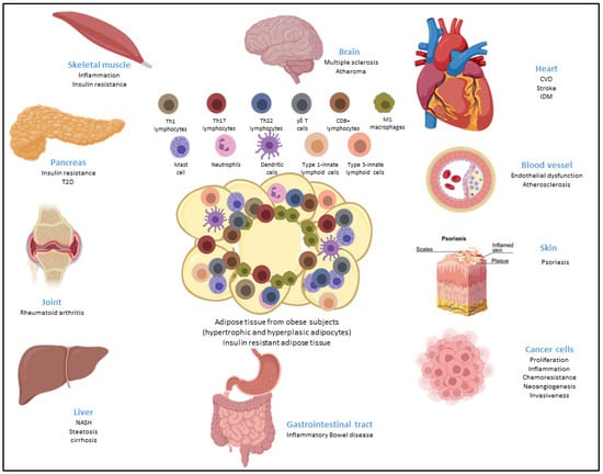 Cells | Free Full-Text | Pathogenic Role of Adipose Tissue-Derived ...