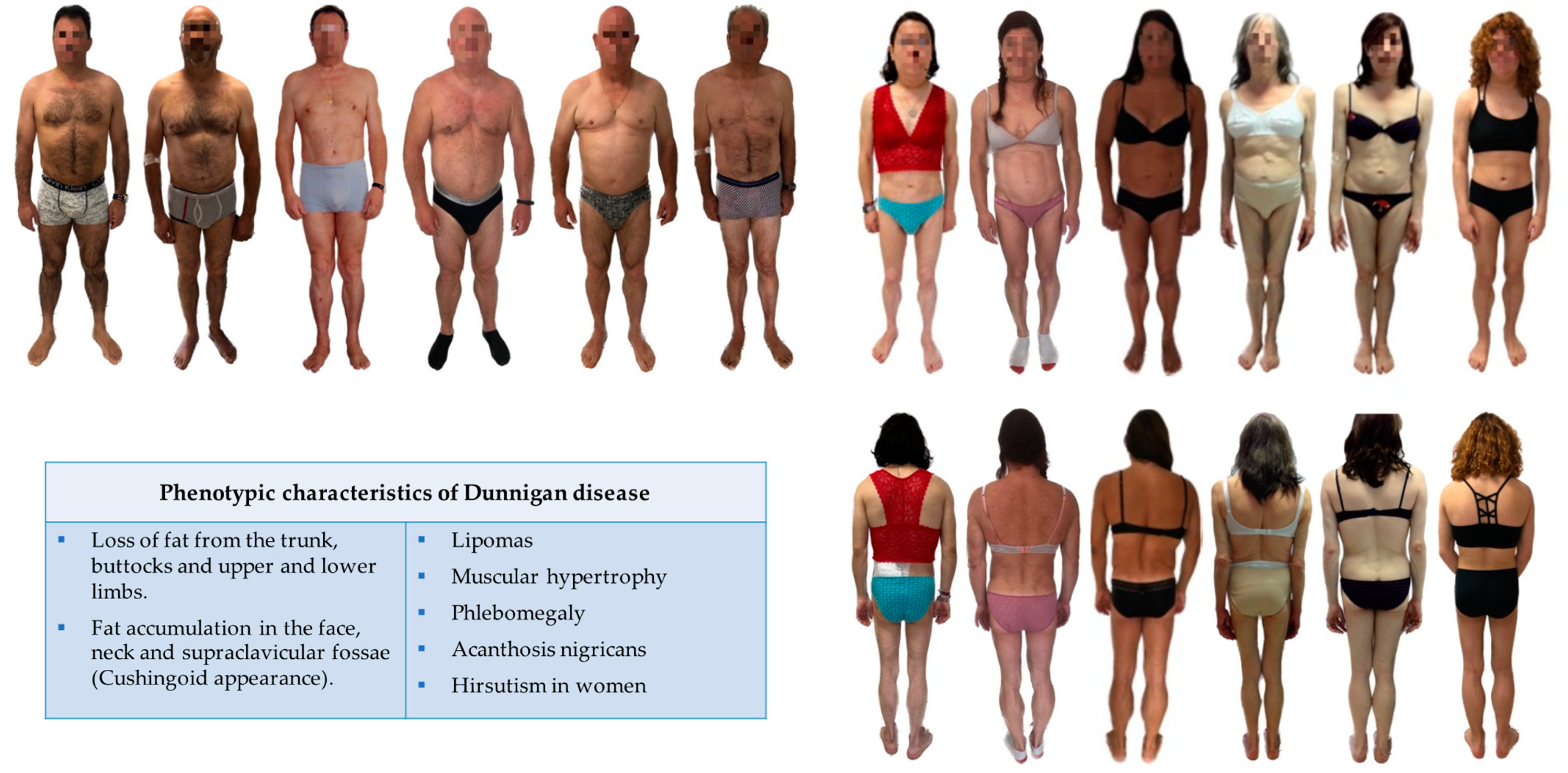 Cells | Free Full-Text | Clinical Spectrum of LMNA-Associated Type 