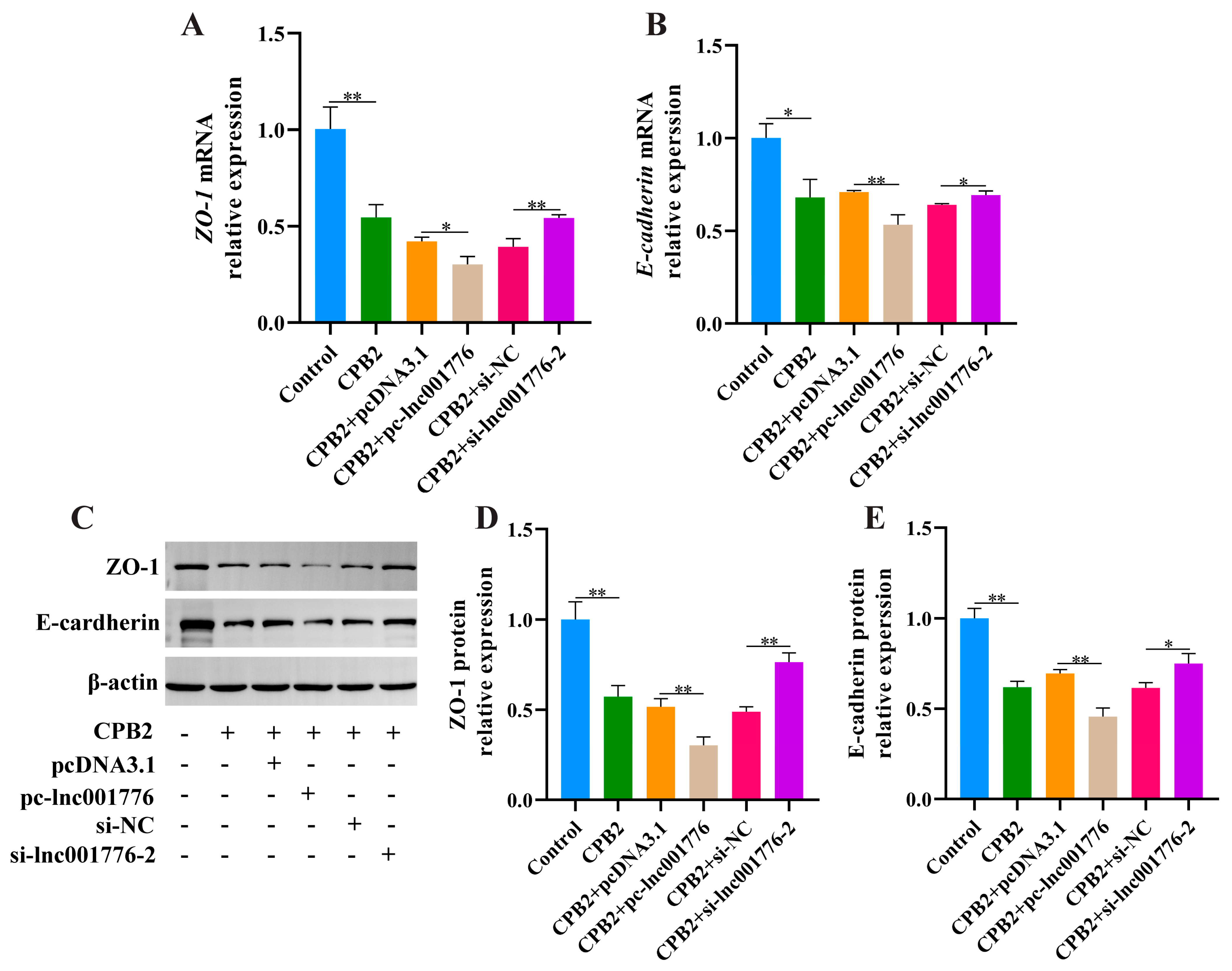 Cells | Free Full-Text | Lnc001776 Affects CPB2 Toxin-Induced Excessive ...