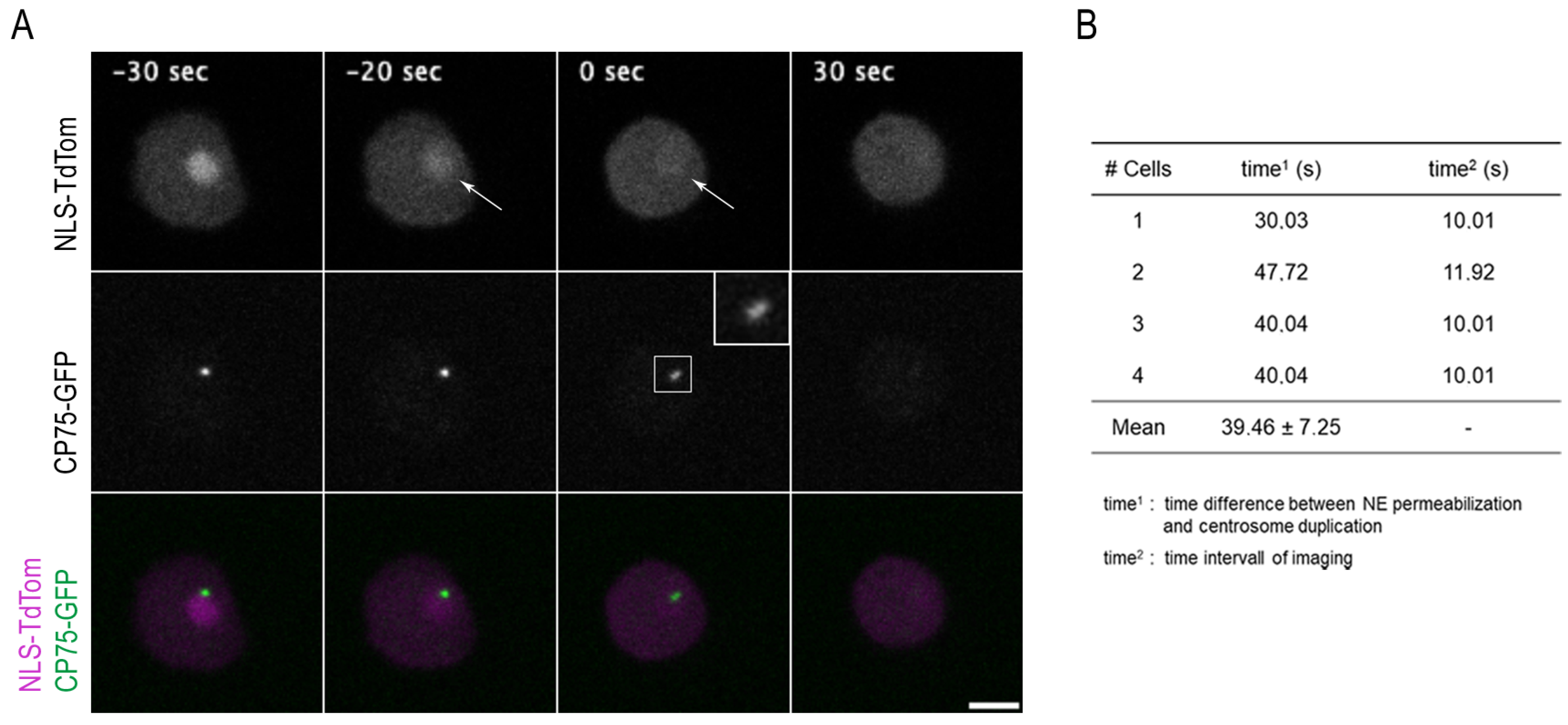 Cells | Free Full-Text | Temporal Changes in Nuclear Envelope ...