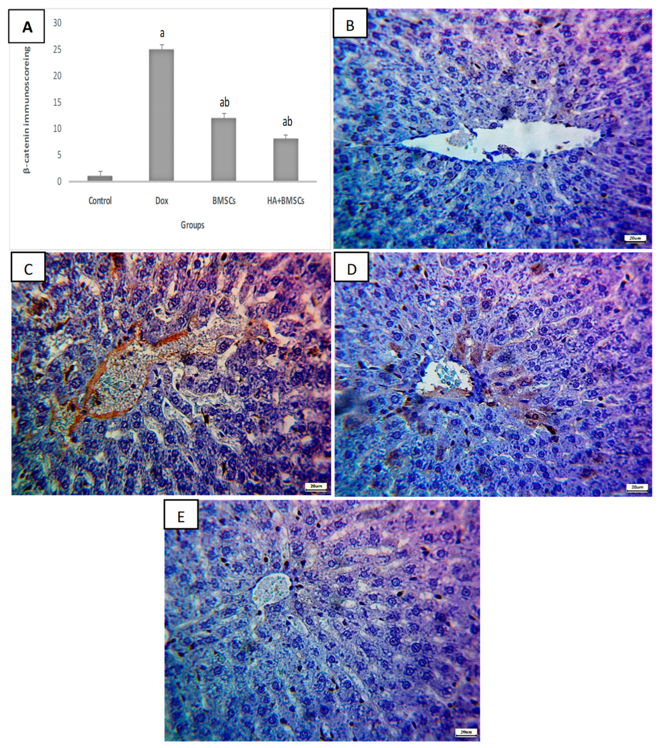 Cells | Free Full-Text | Hepatoprotective Effects of Hyaluronic  Acid-Preconditioned Bone Marrow Mesenchymal Stem Cells against Liver  Toxicity via the Inhibition of Apoptosis and the Wnt/&beta;-Catenin  Signaling Pathway