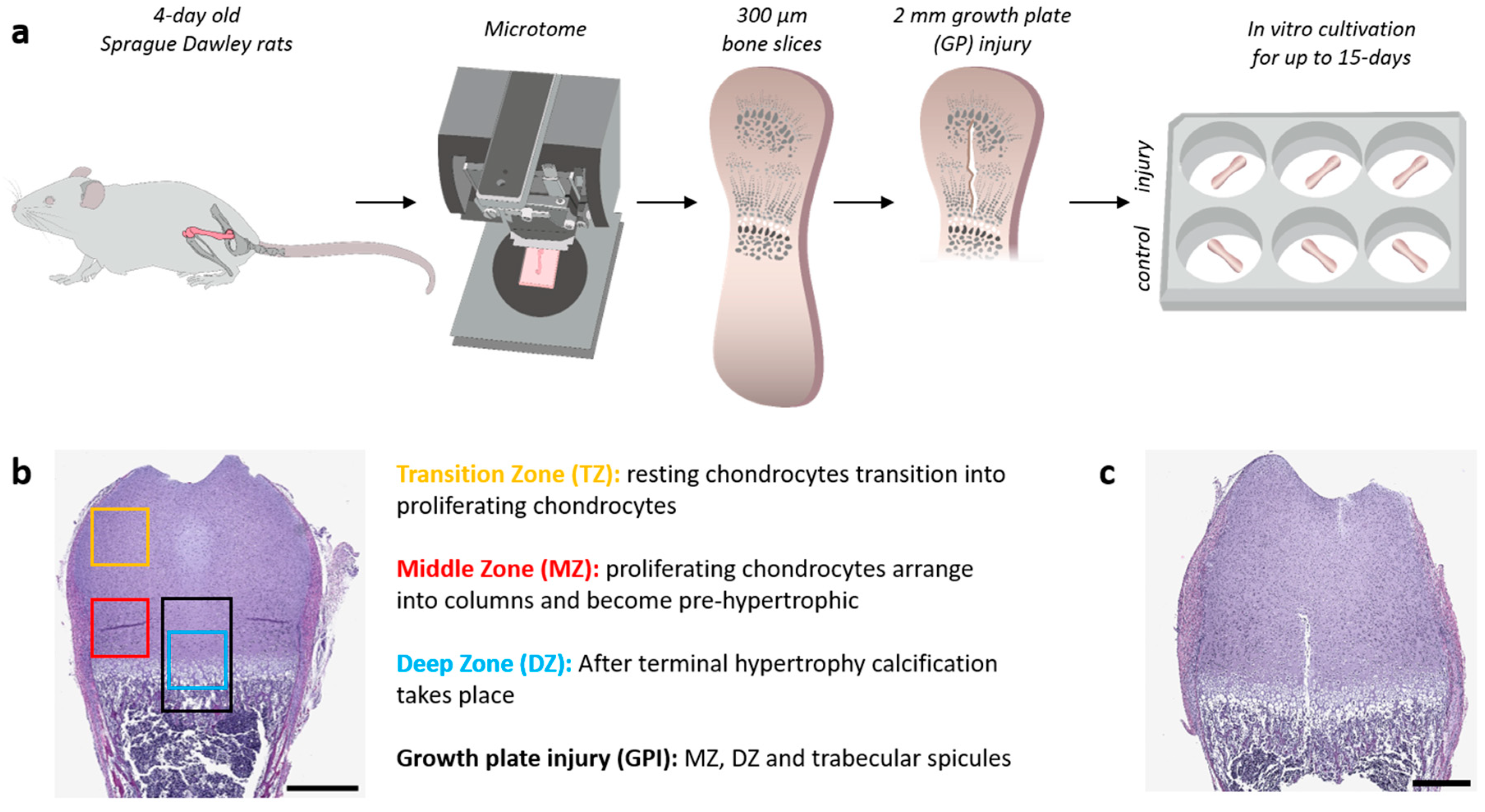 Cells | Free Full-Text | Disruption of Endochondral Ossification and  Extracellular Matrix Maturation in an Ex Vivo Rat Femur Organotypic Slice  Model Due to Growth Plate Injury