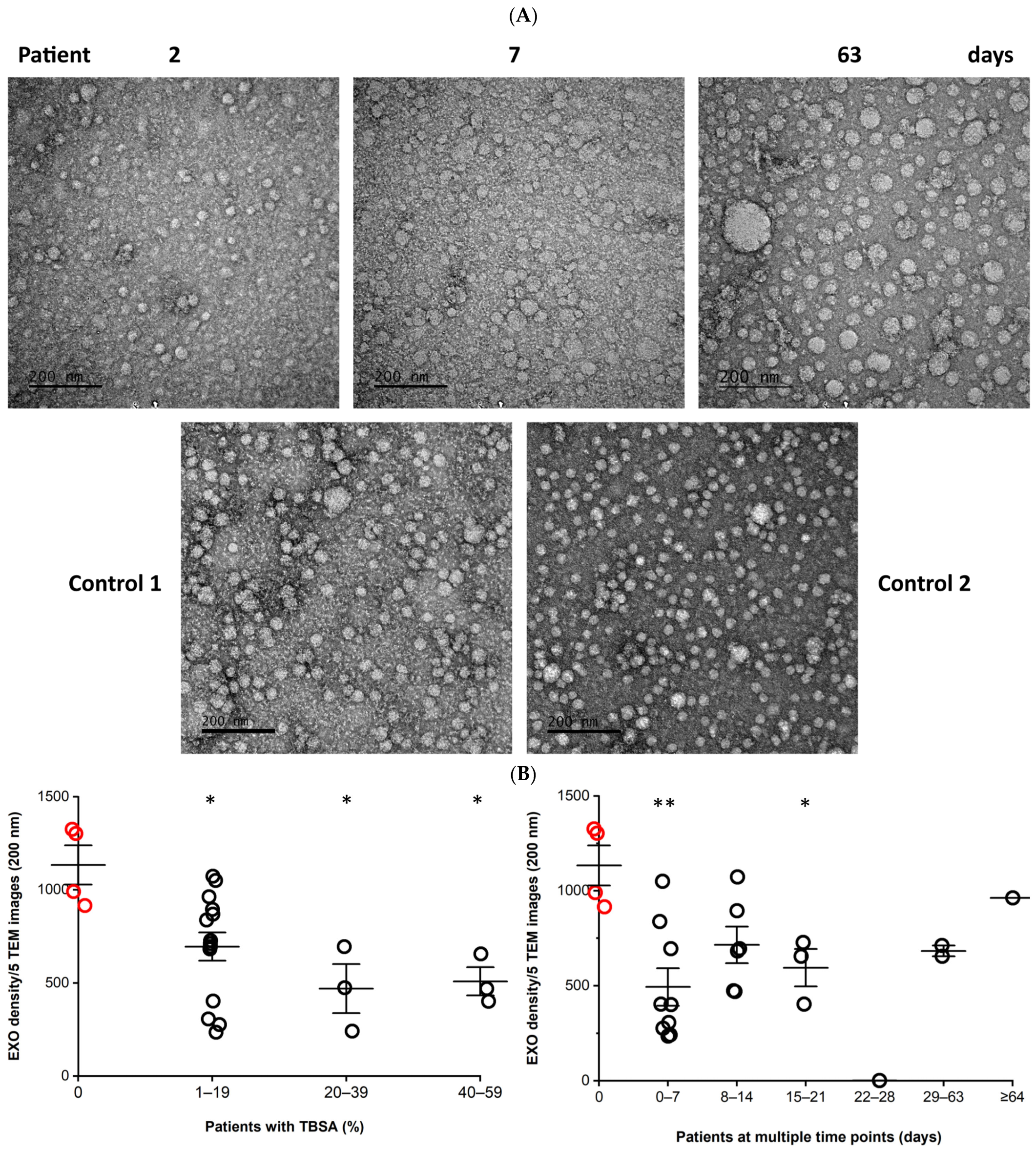 Cells | Free Full-Text | Characteristics of Serum Exosomes after Burn  Injury and Dermal Fibroblast Regulation by Exosomes In Vitro