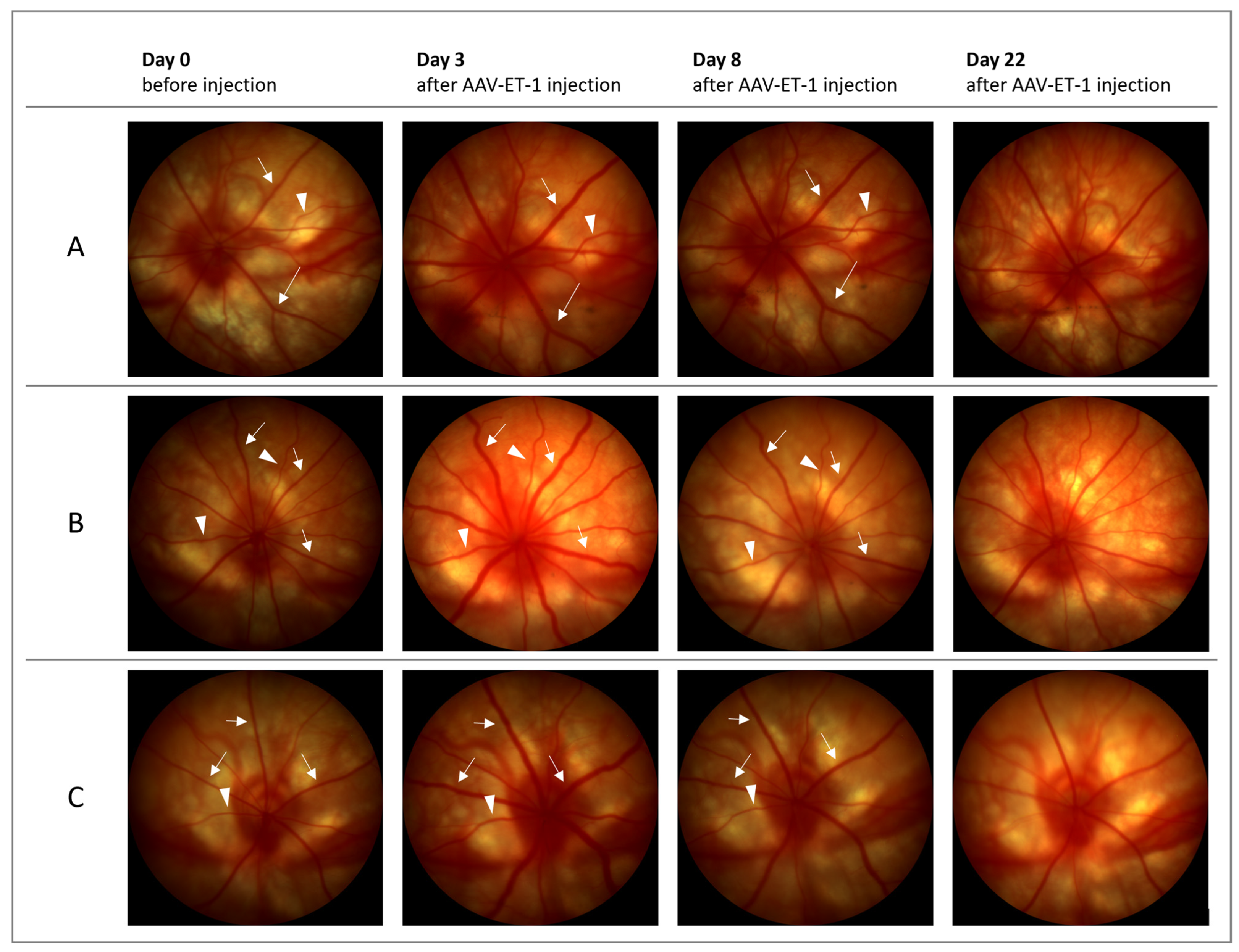 Cells Free Full Text Intraocular Adeno Associated Virus