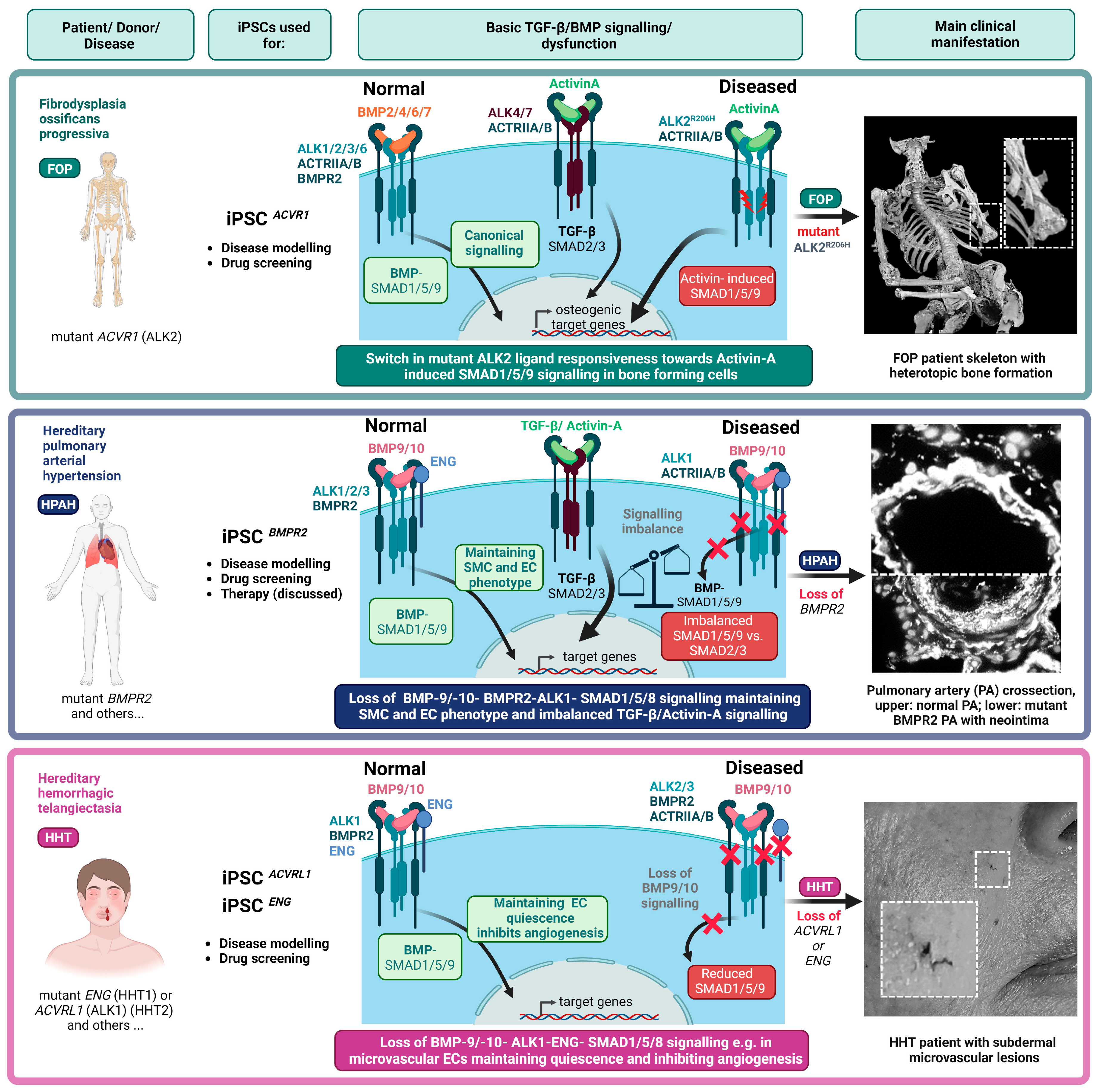 Cells Free Full Text Human iPSCs as Model Systems for BMP