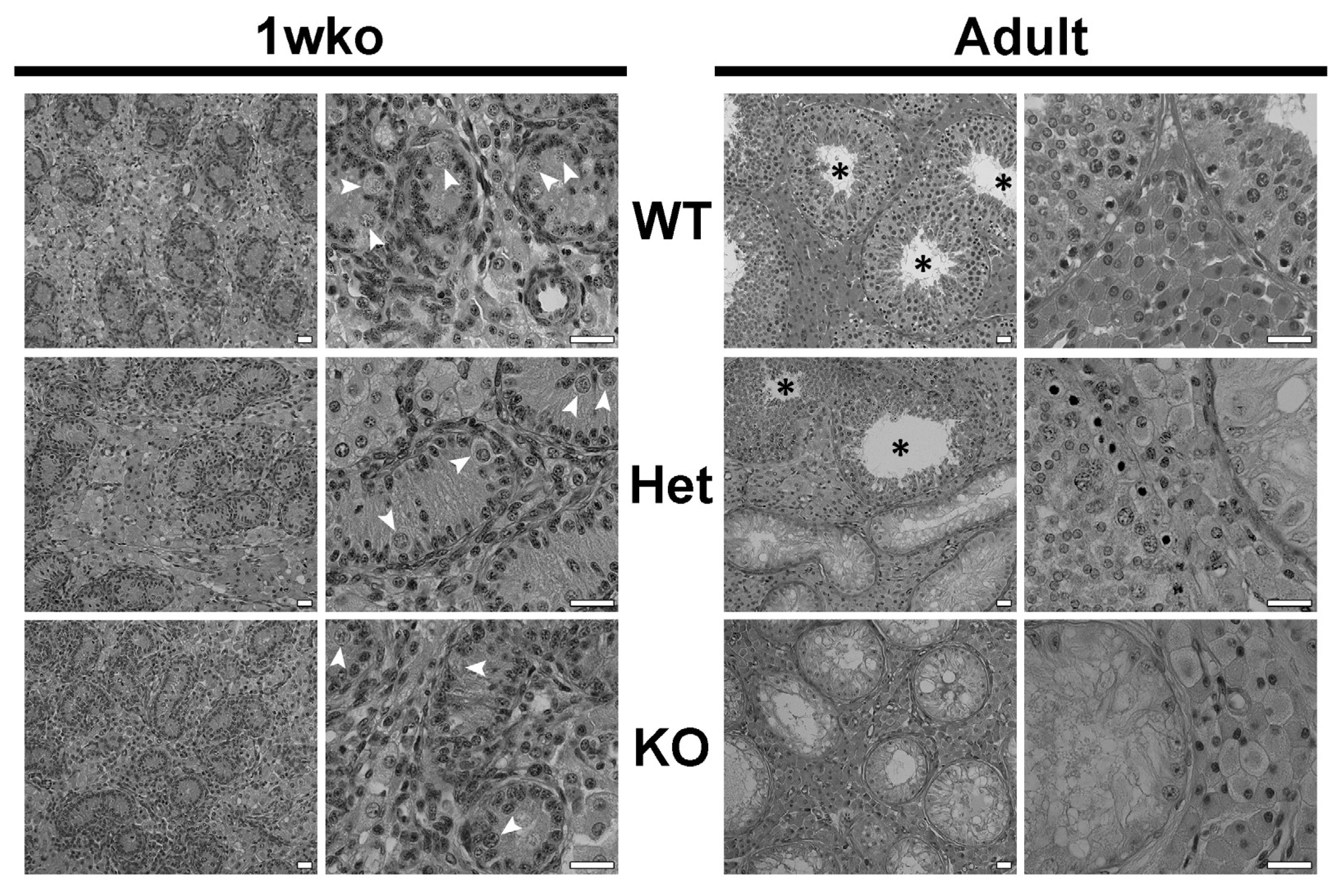 Cells | Free Full-Text | DAZL Knockout Pigs as Recipients for