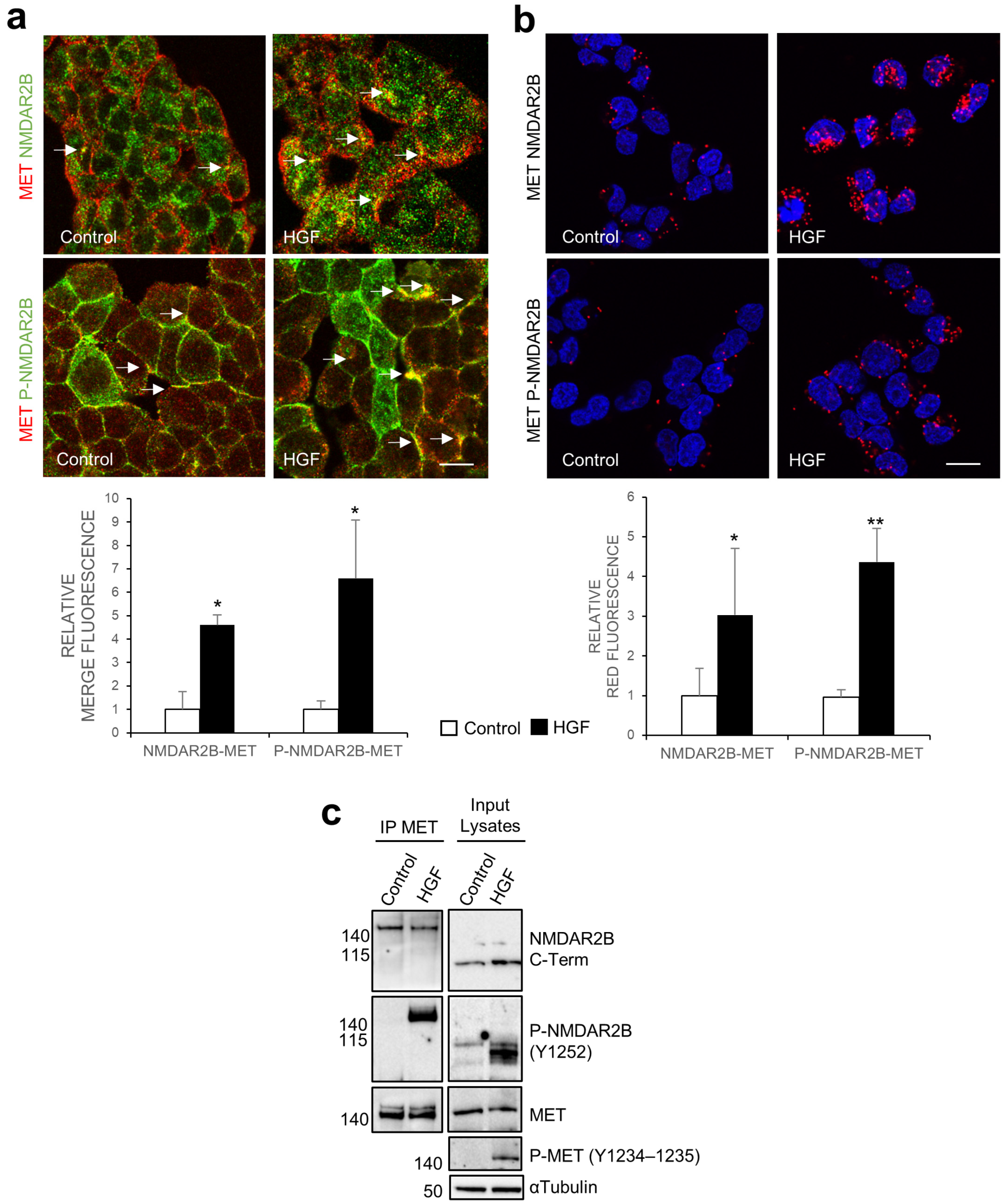 Cells | Free Full-Text | MET Oncogene Enhances Pro-Migratory