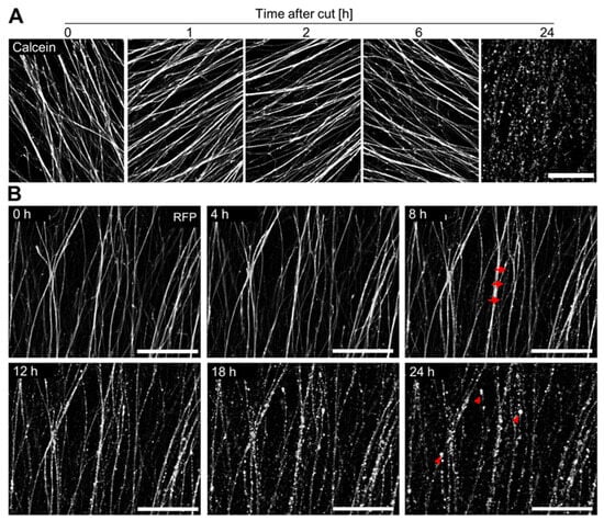 Cells | Free Full-Text | Preparation of Viable Human Neurites for 