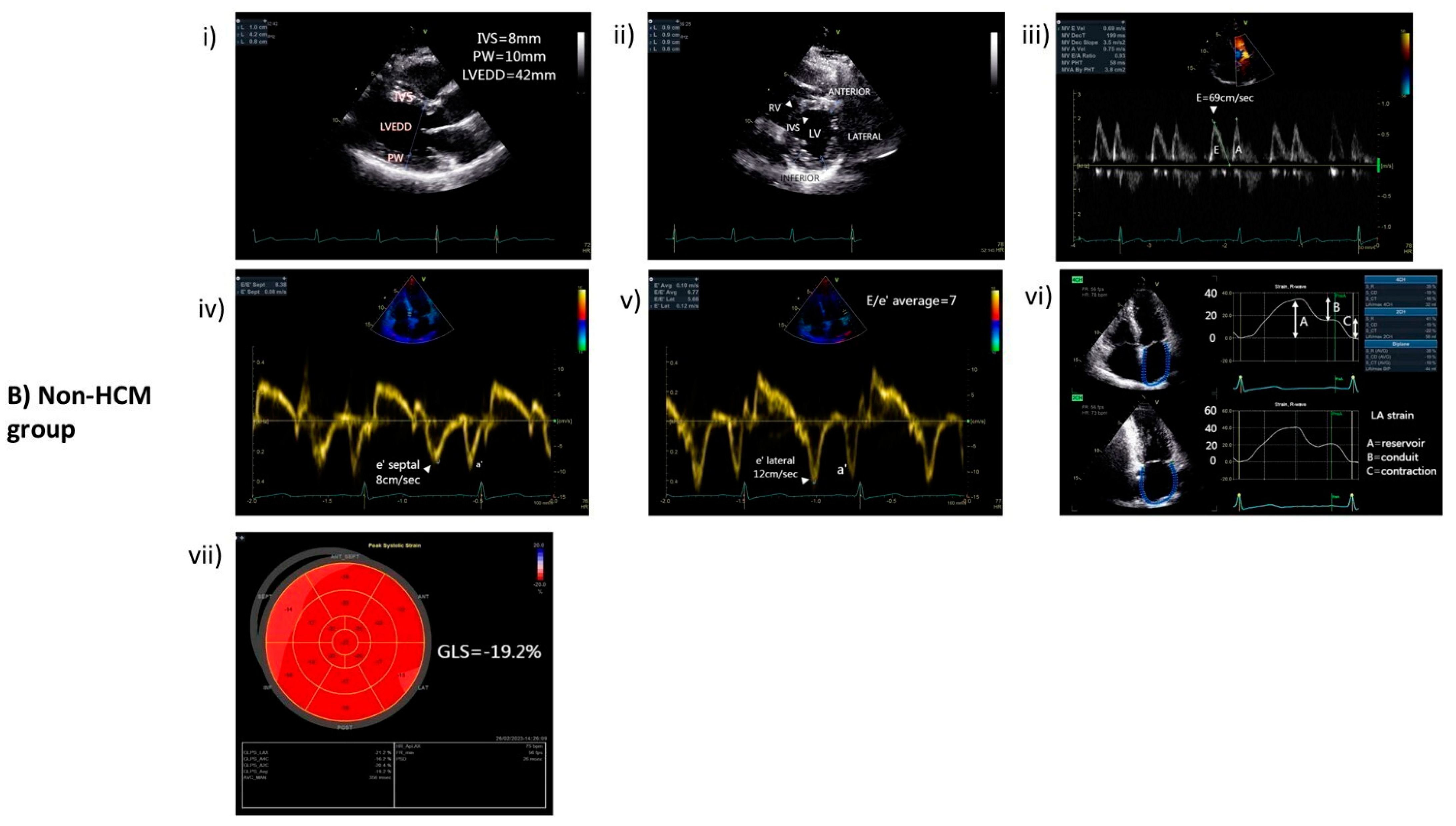 Cells 13 01328 g001b
